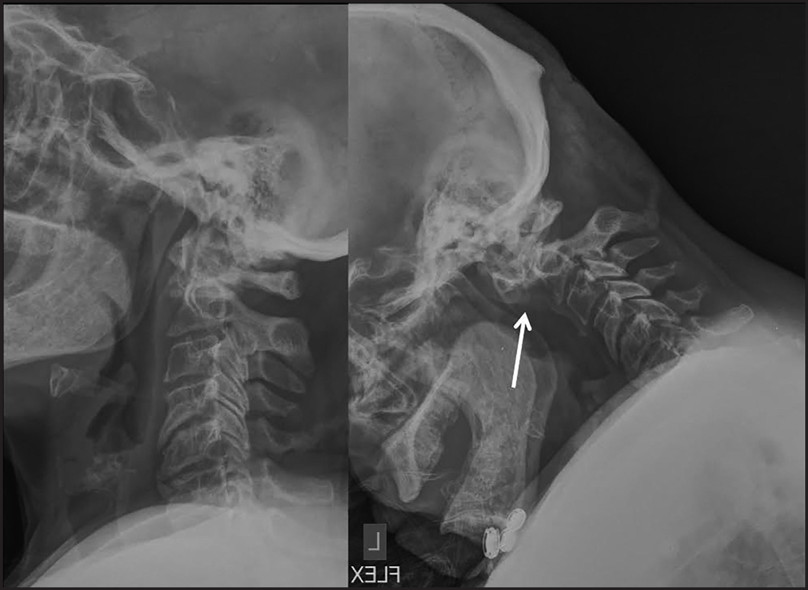 FIGURE 14.