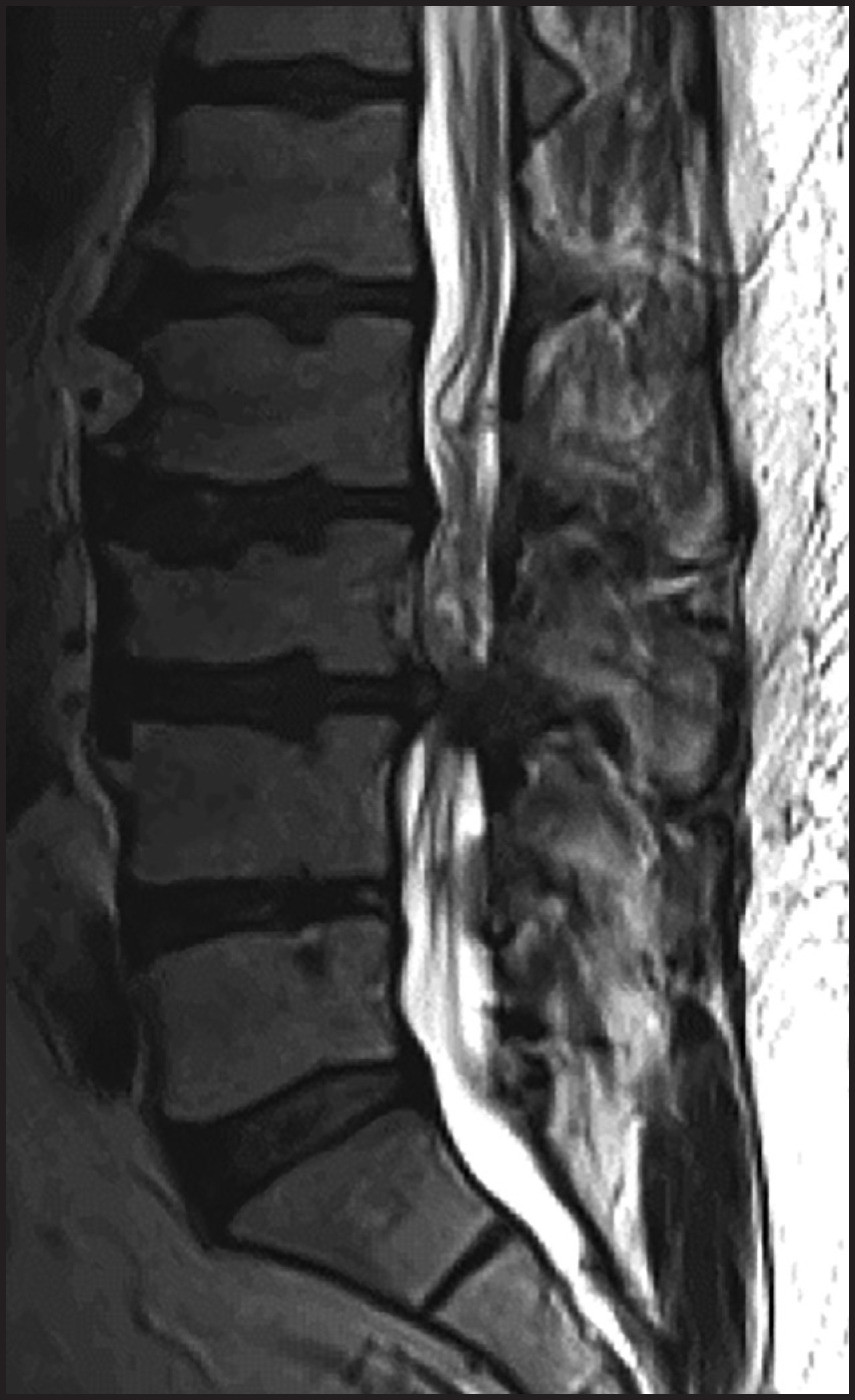 FIGURE 17.