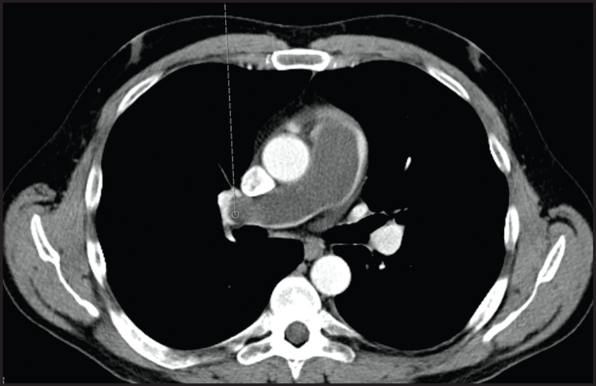FIGURE 3.