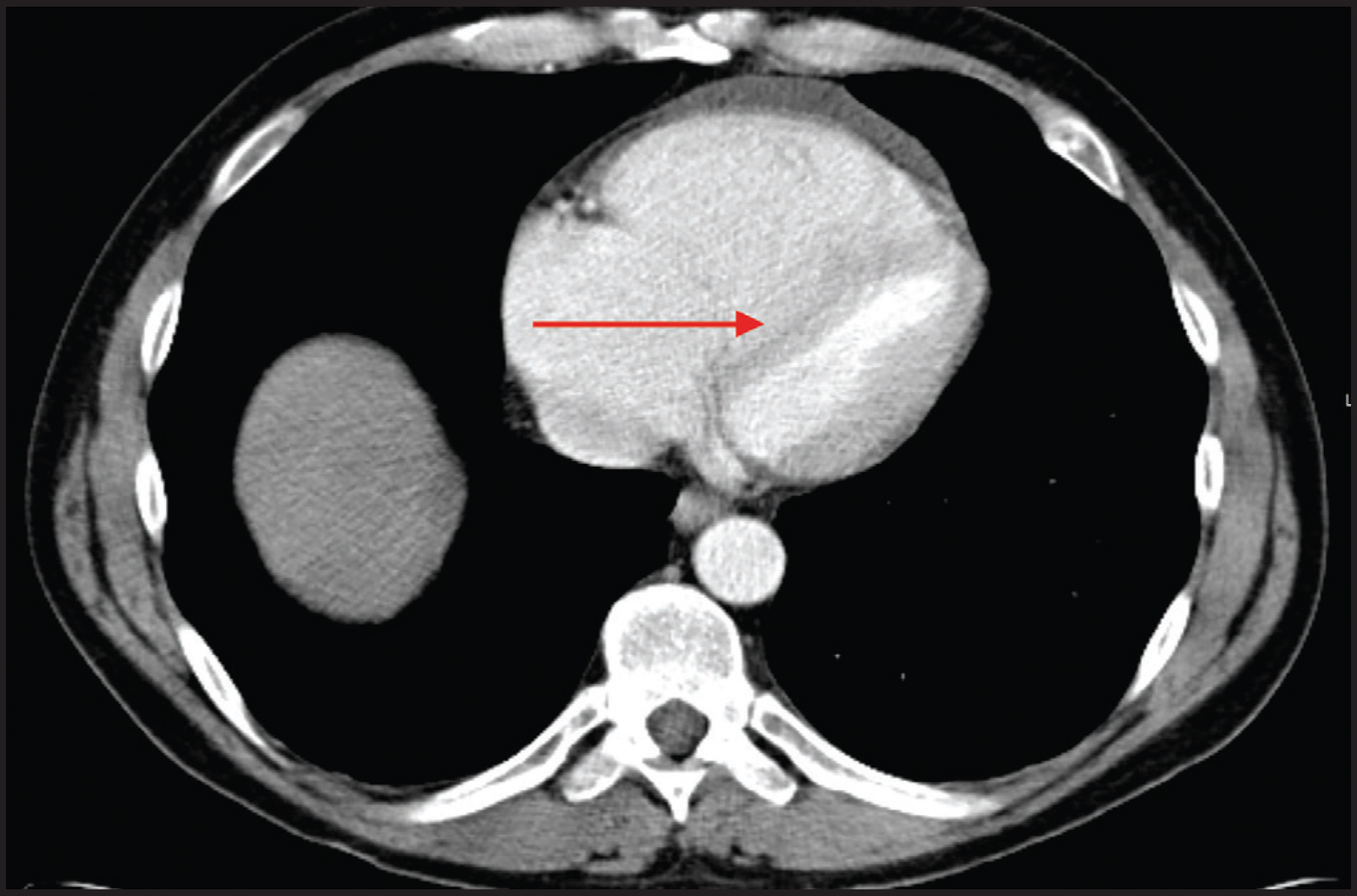 FIGURE 4.