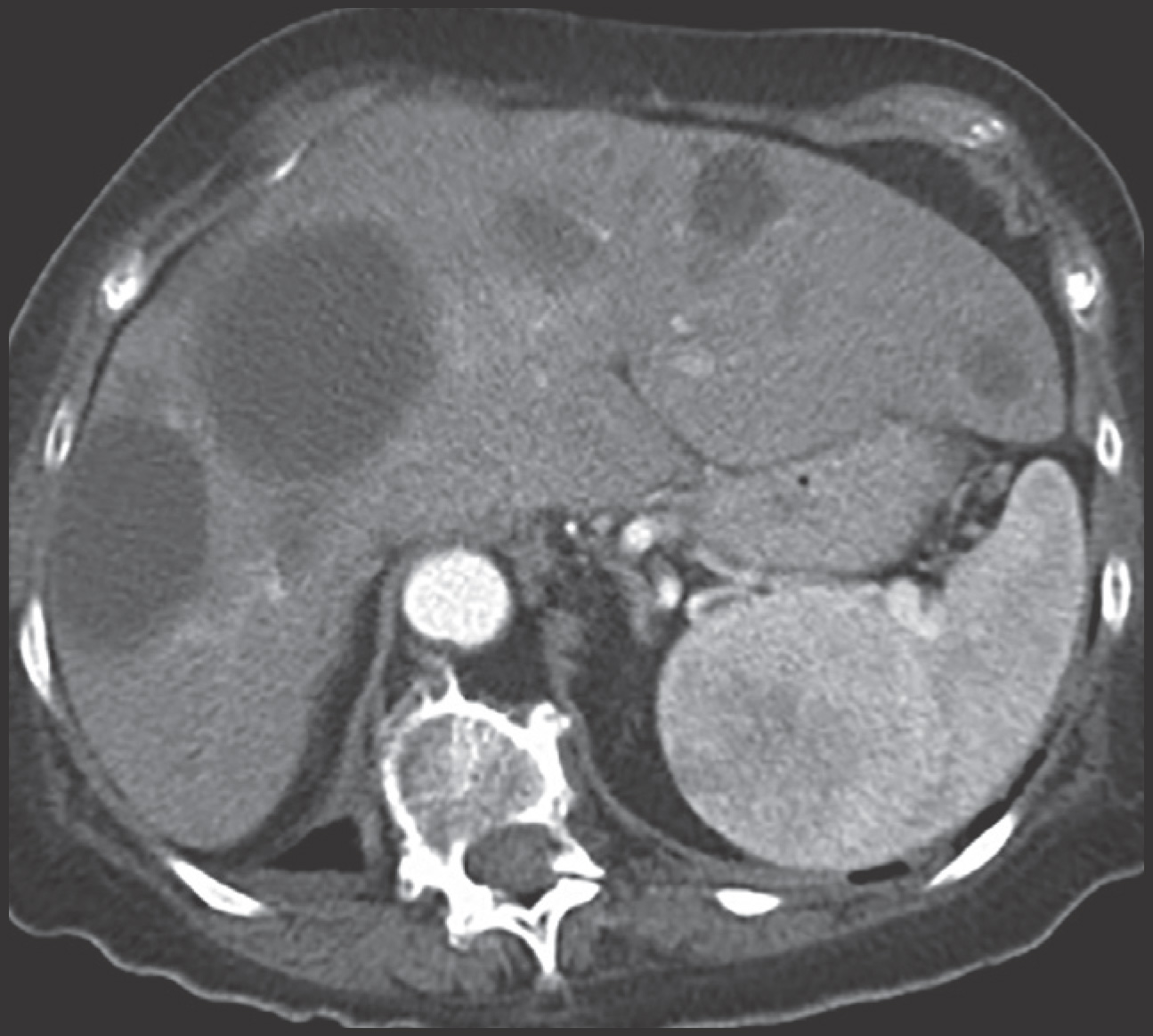 FIGURE 11.