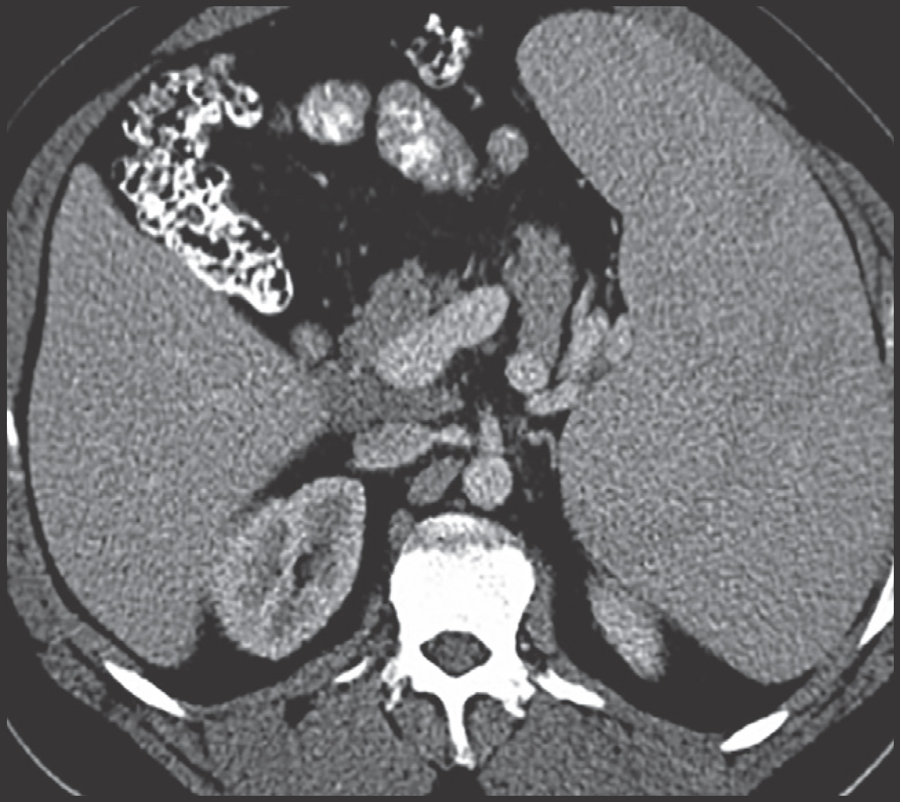FIGURE 13.