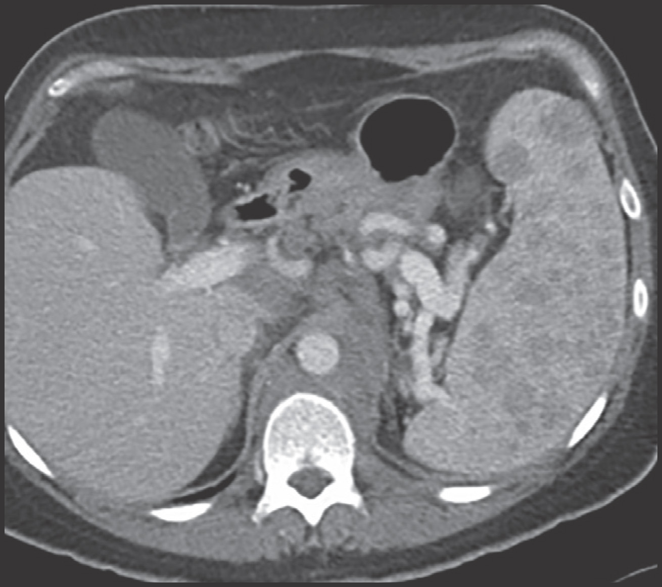 FIGURE 14.