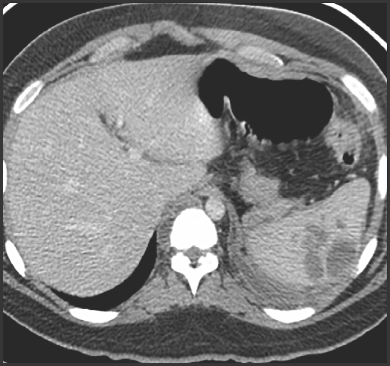 FIGURE 16.