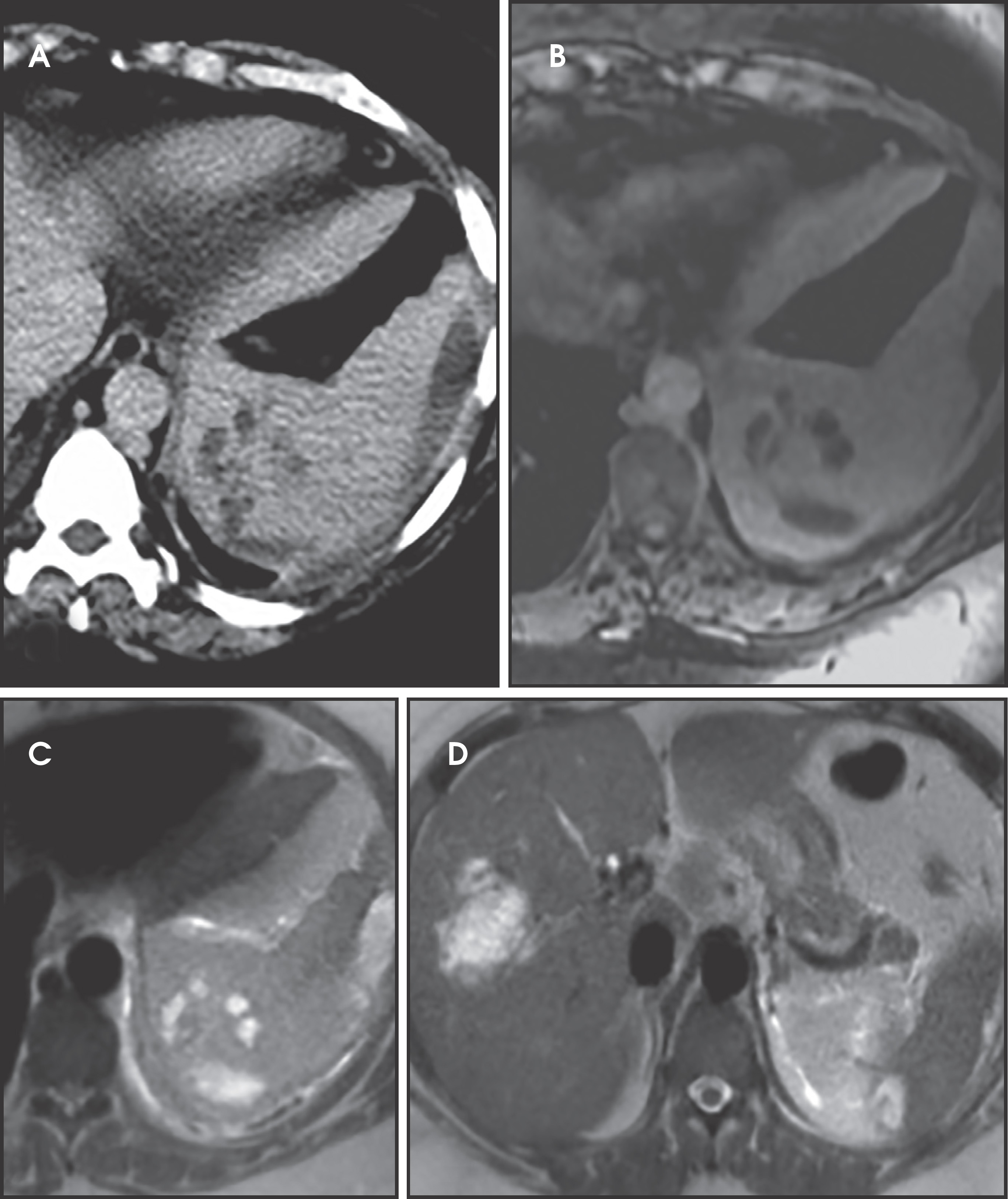 FIGURE 17.