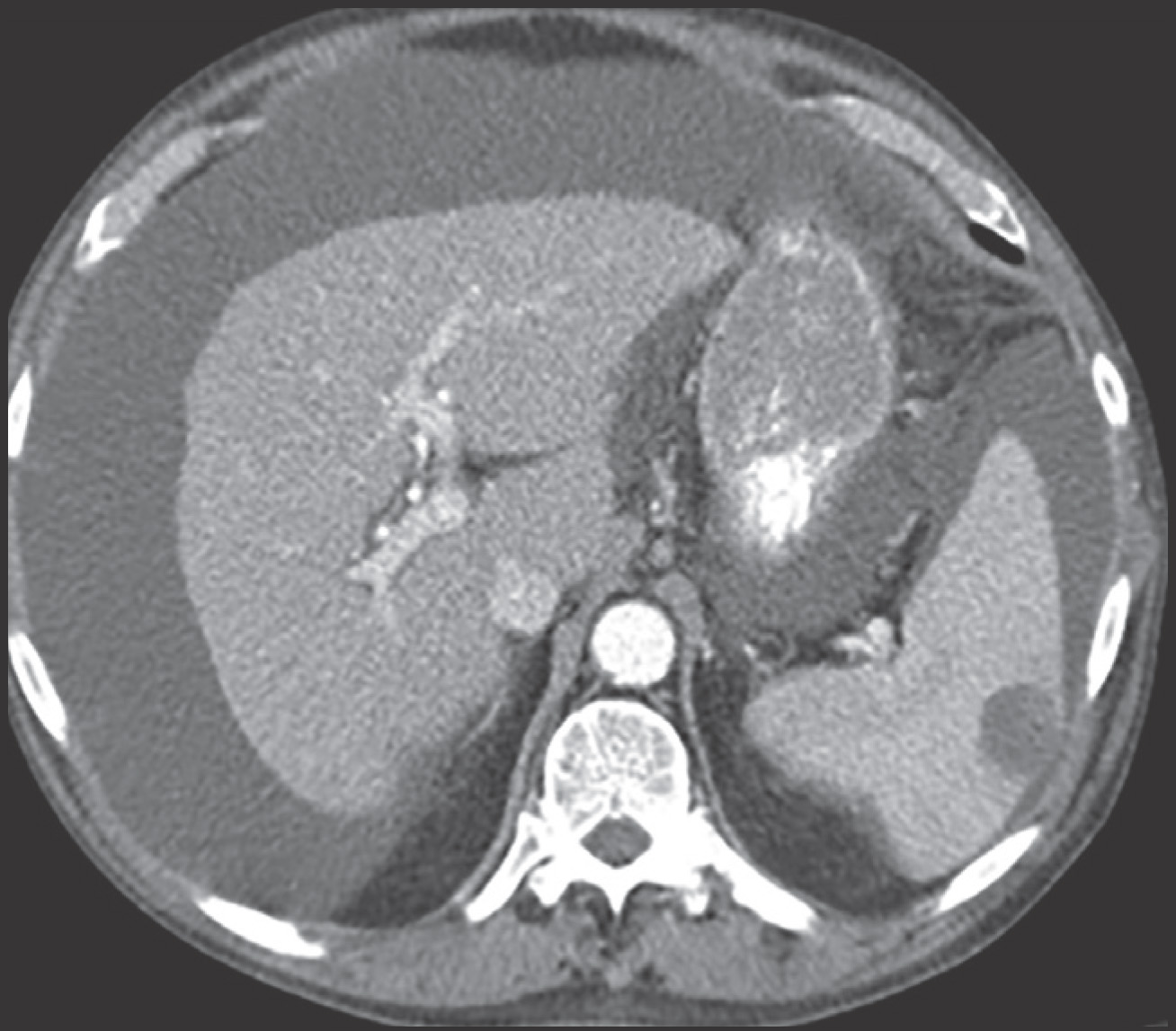 FIGURE 22.