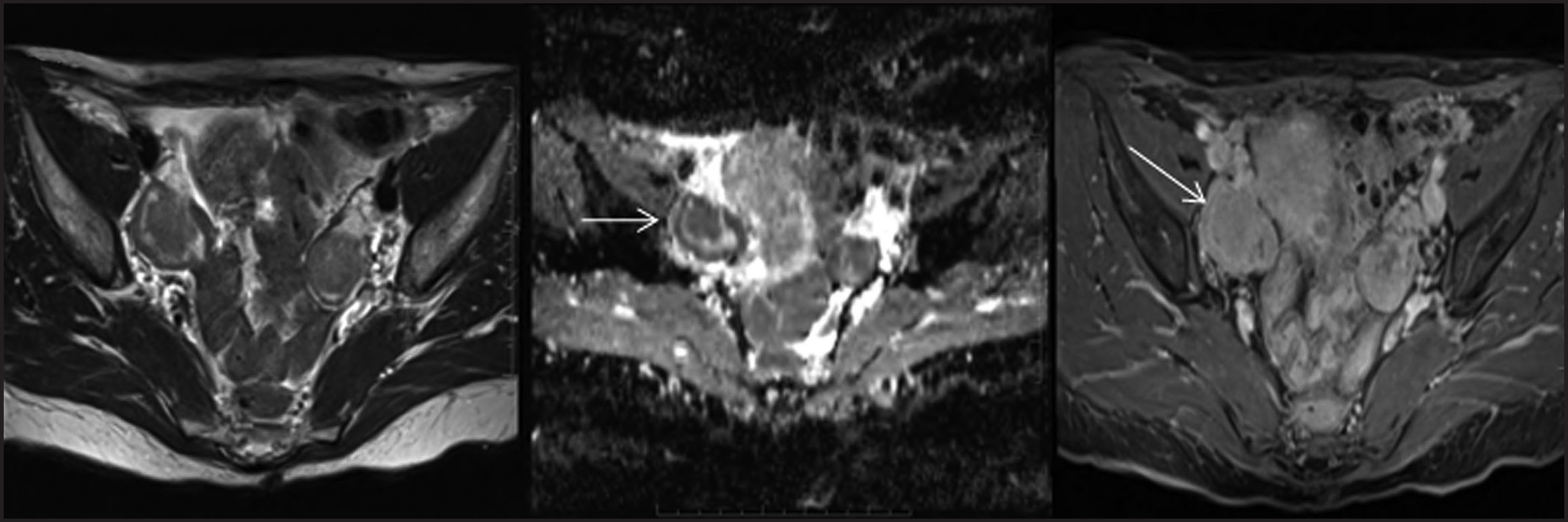 FIGURE 10.