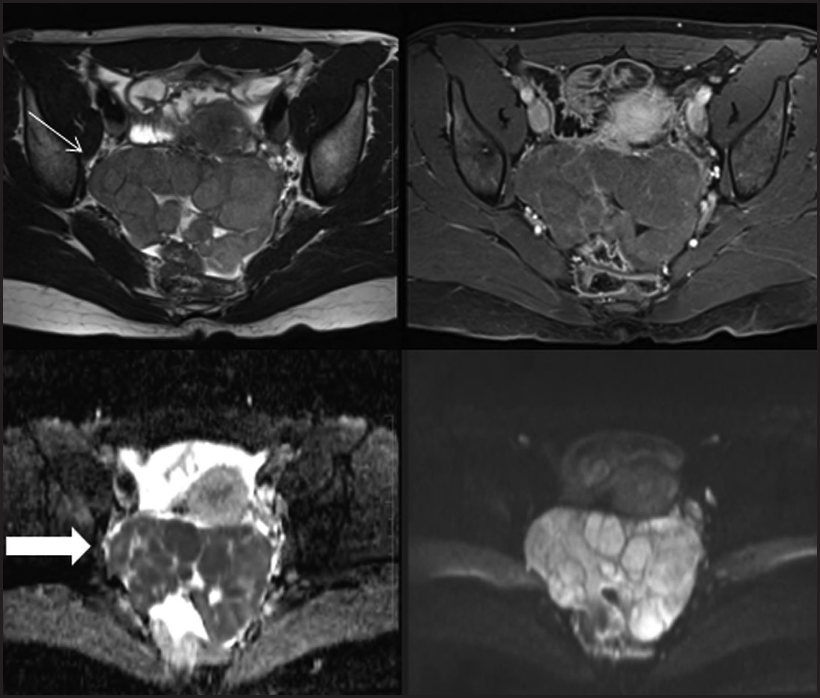 FIGURE 13.