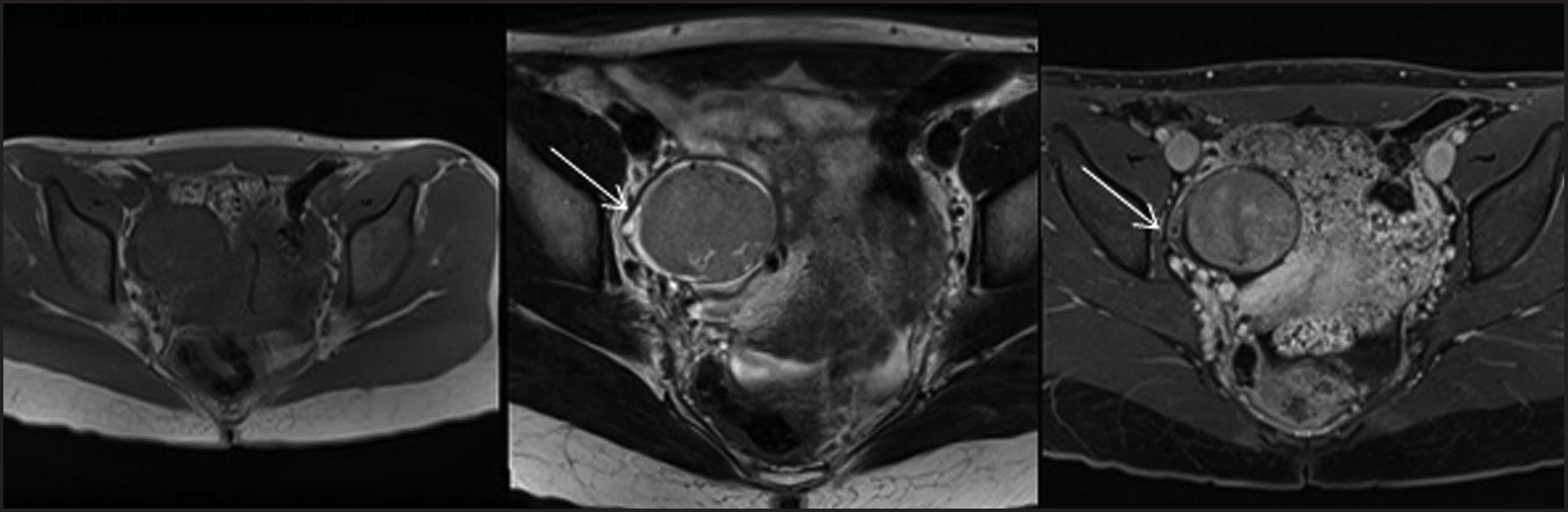 FIGURE 14.