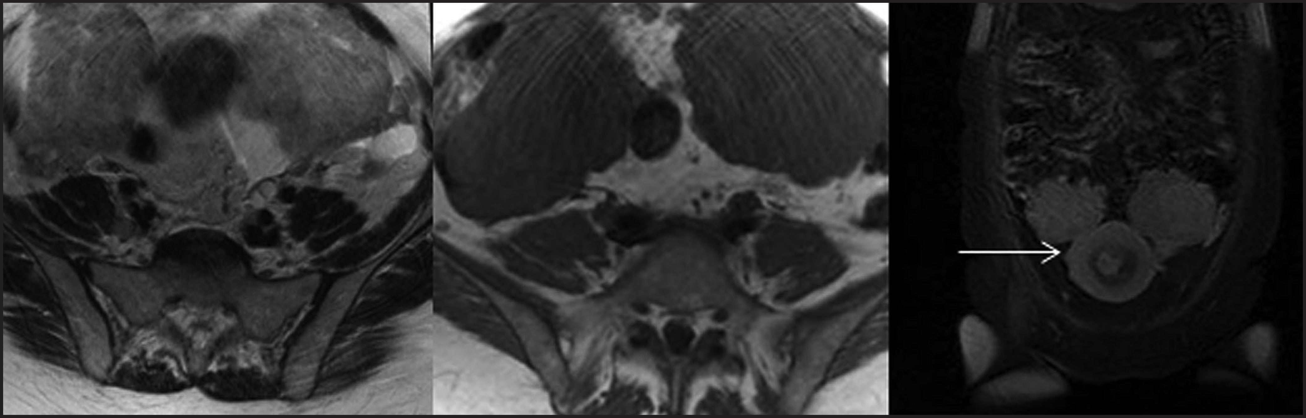 FIGURE 17.