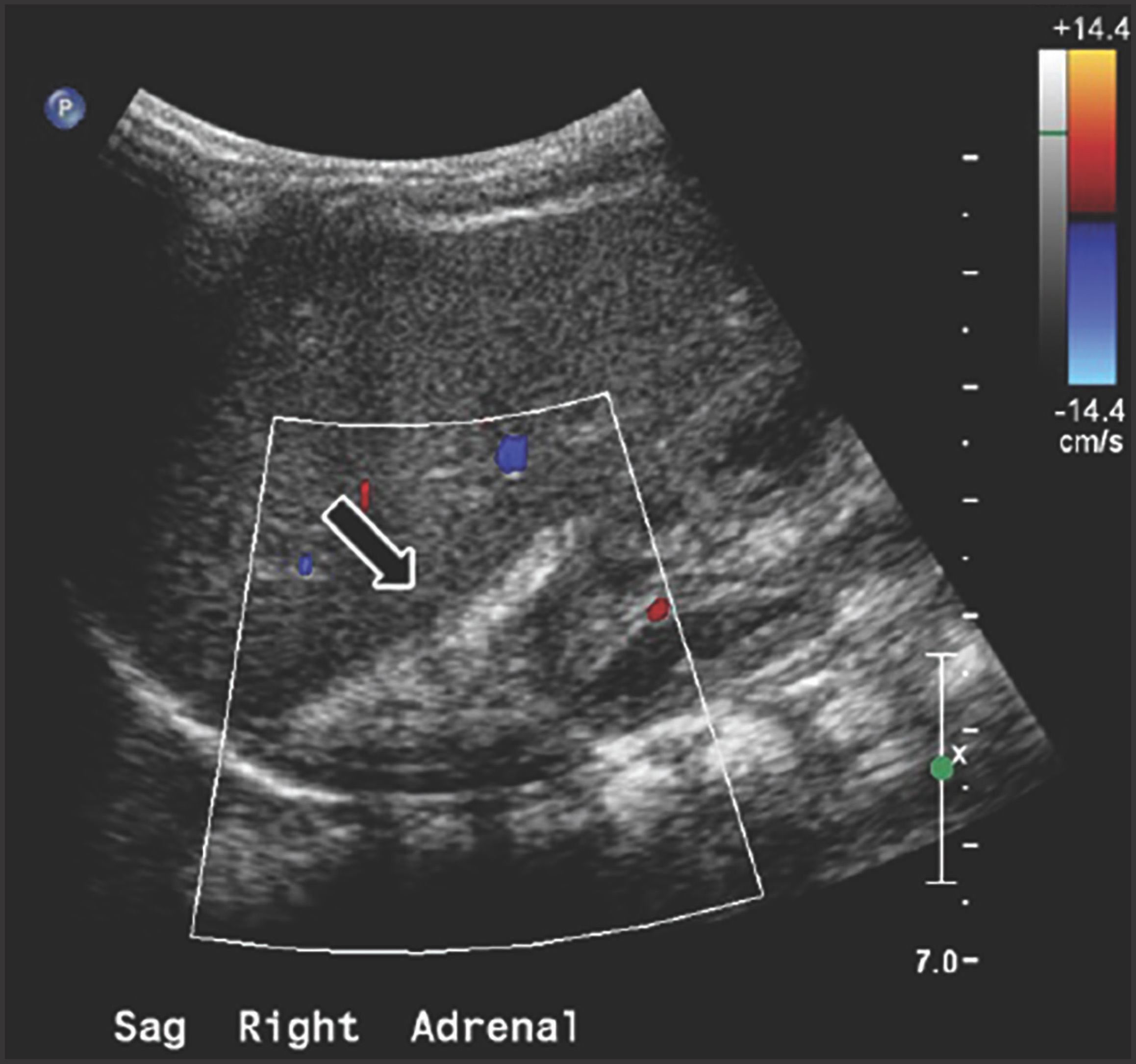 FIGURE 2.