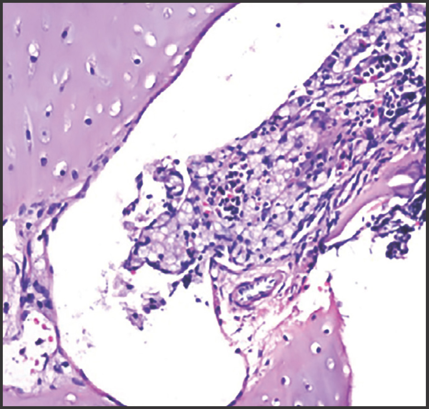 FIGURE 11.