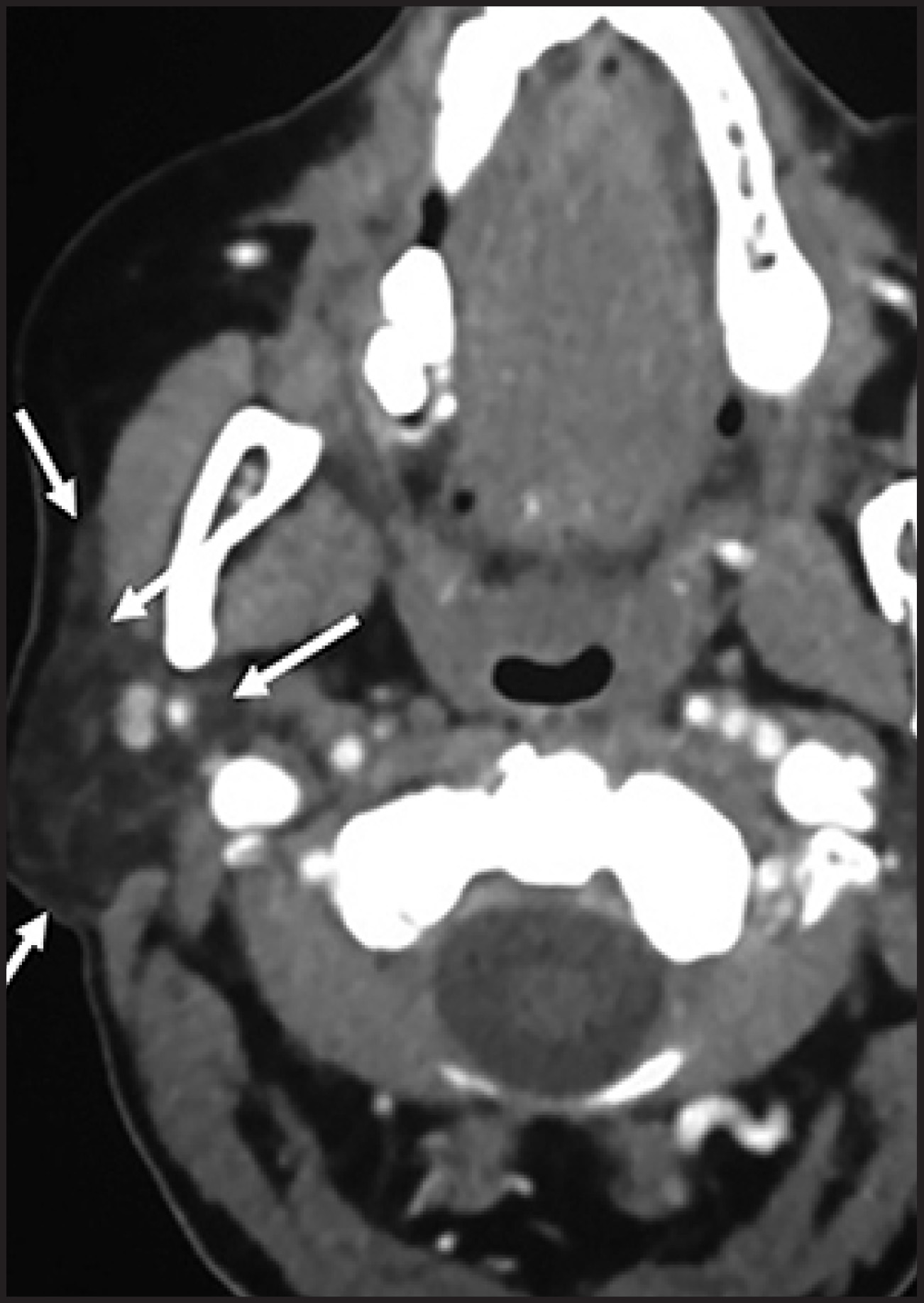 FIGURE 12.