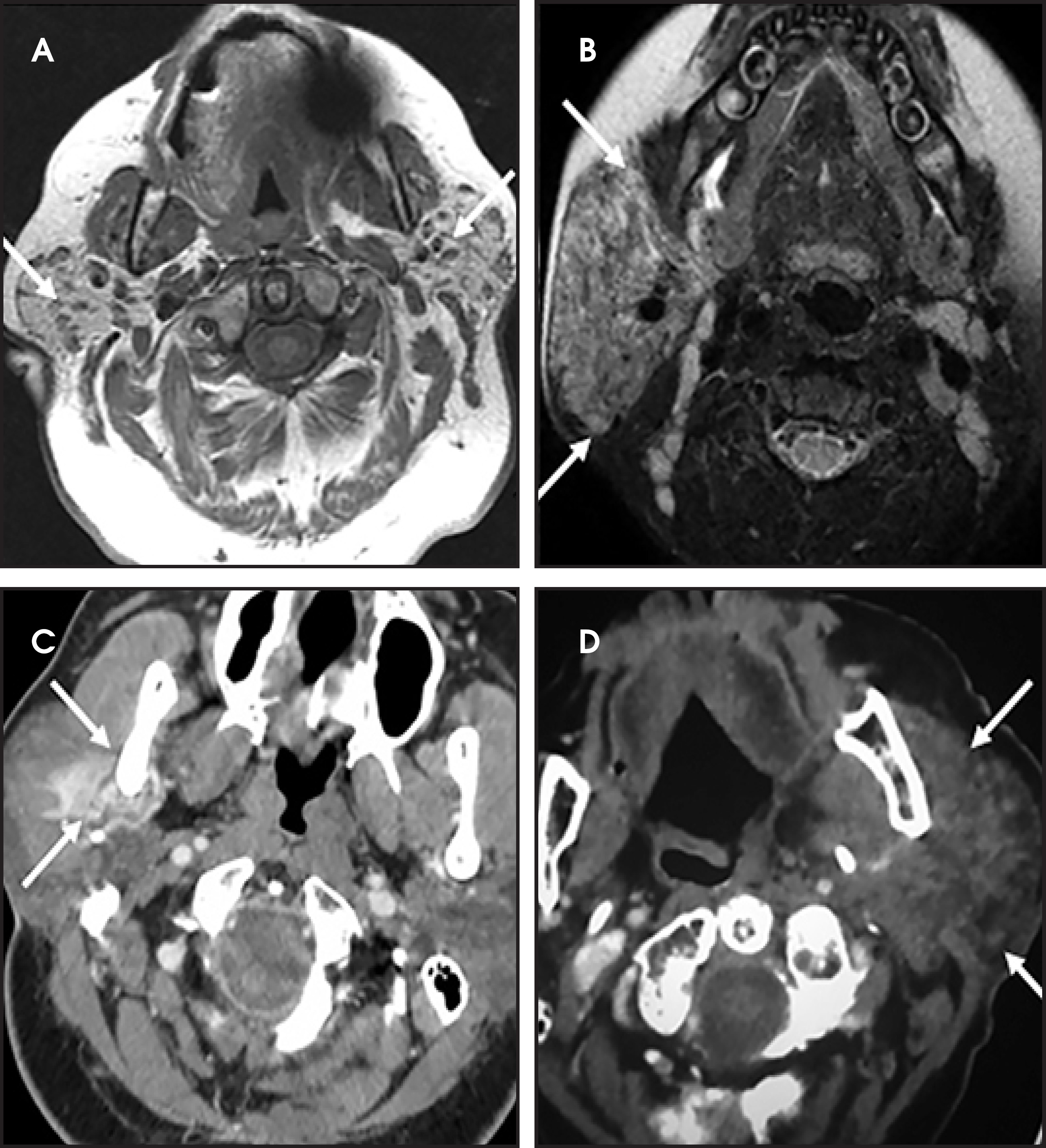 FIGURE 13.