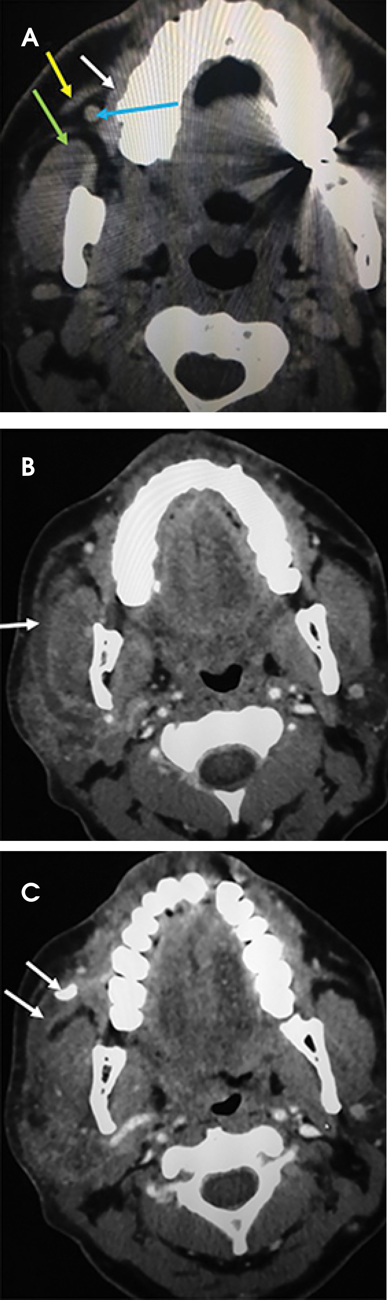 FIGURE 14.
