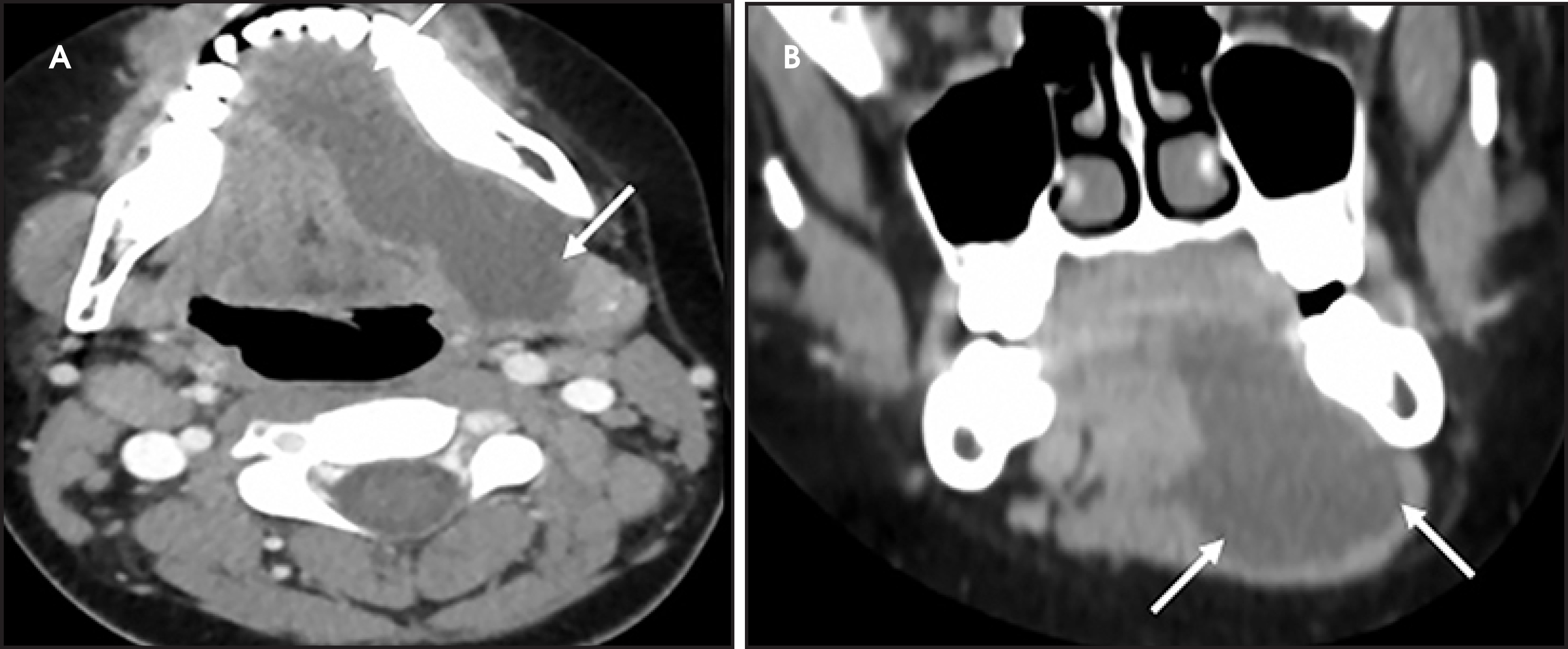 FIGURE 16.