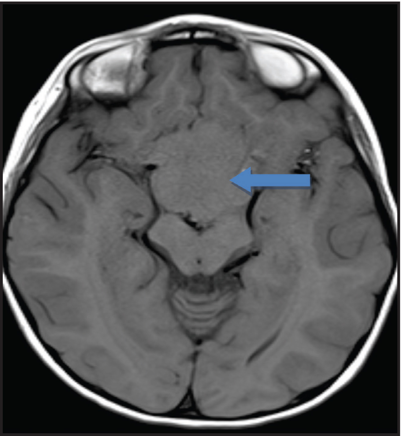 FIGURE 1.