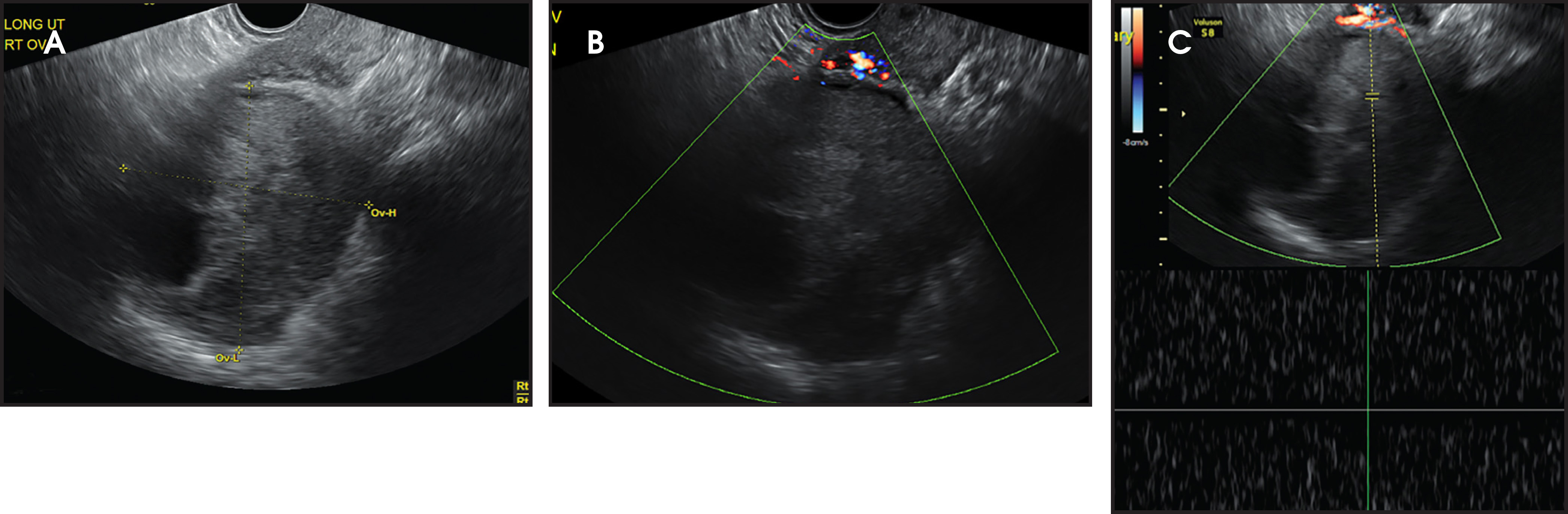 FIGURE 4.