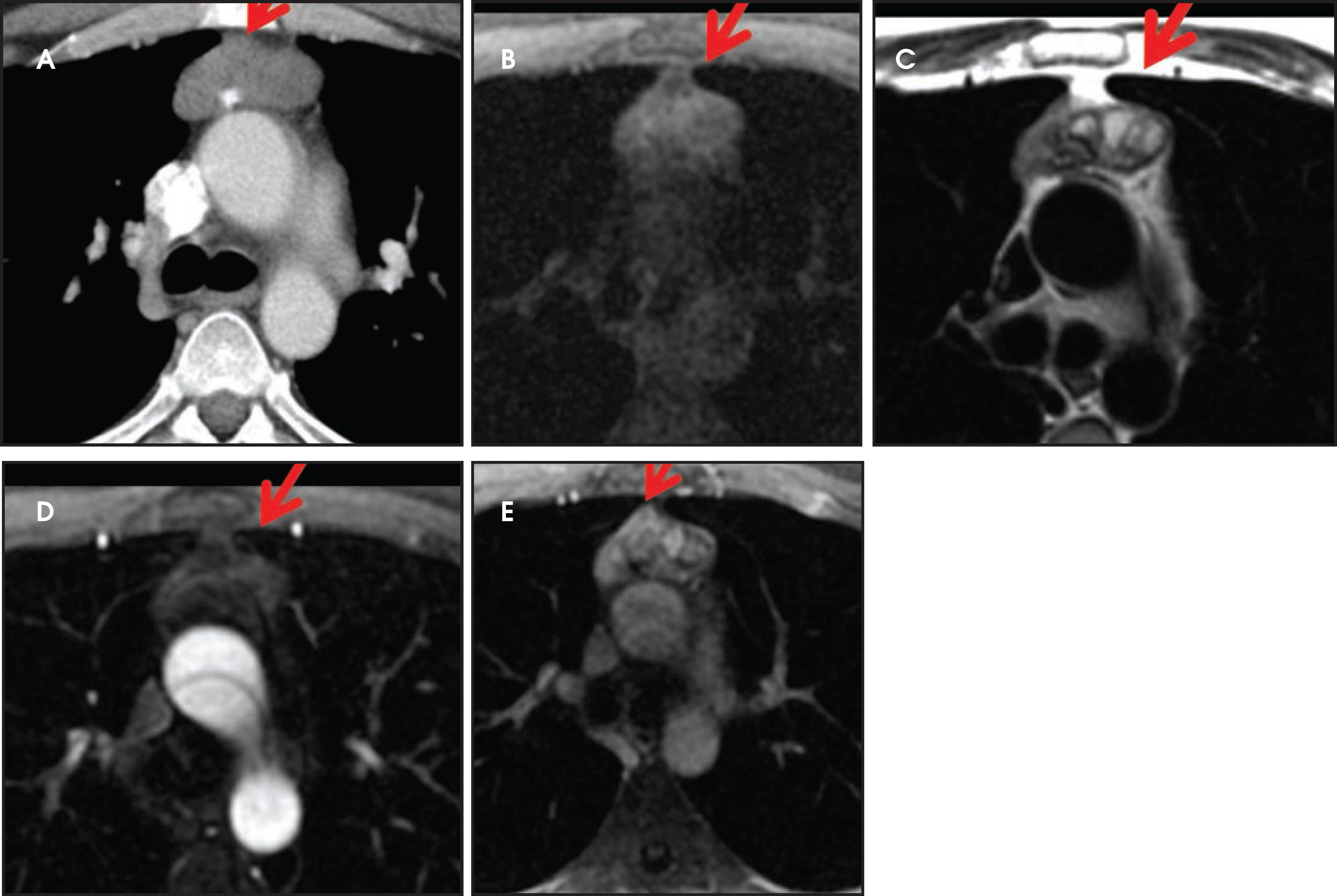 FIGURE 4.