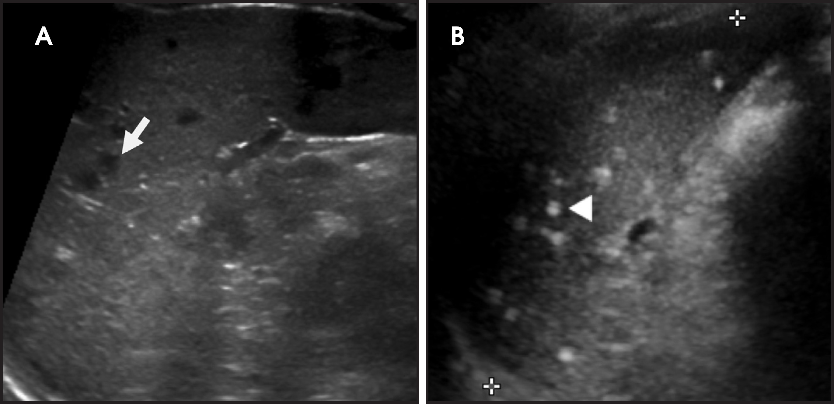 FIGURE 3.