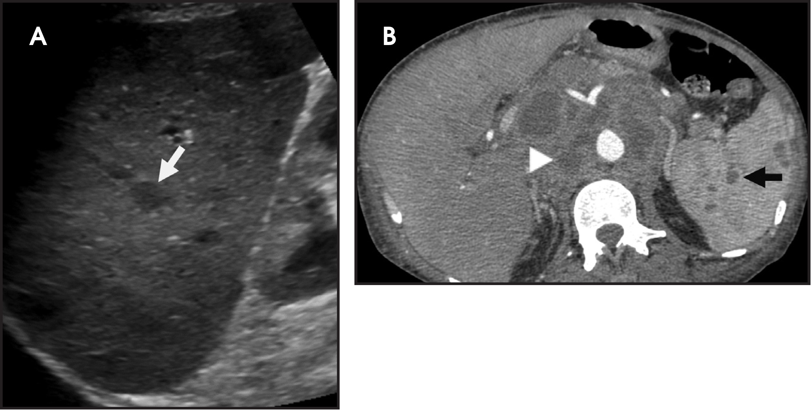 FIGURE 4.