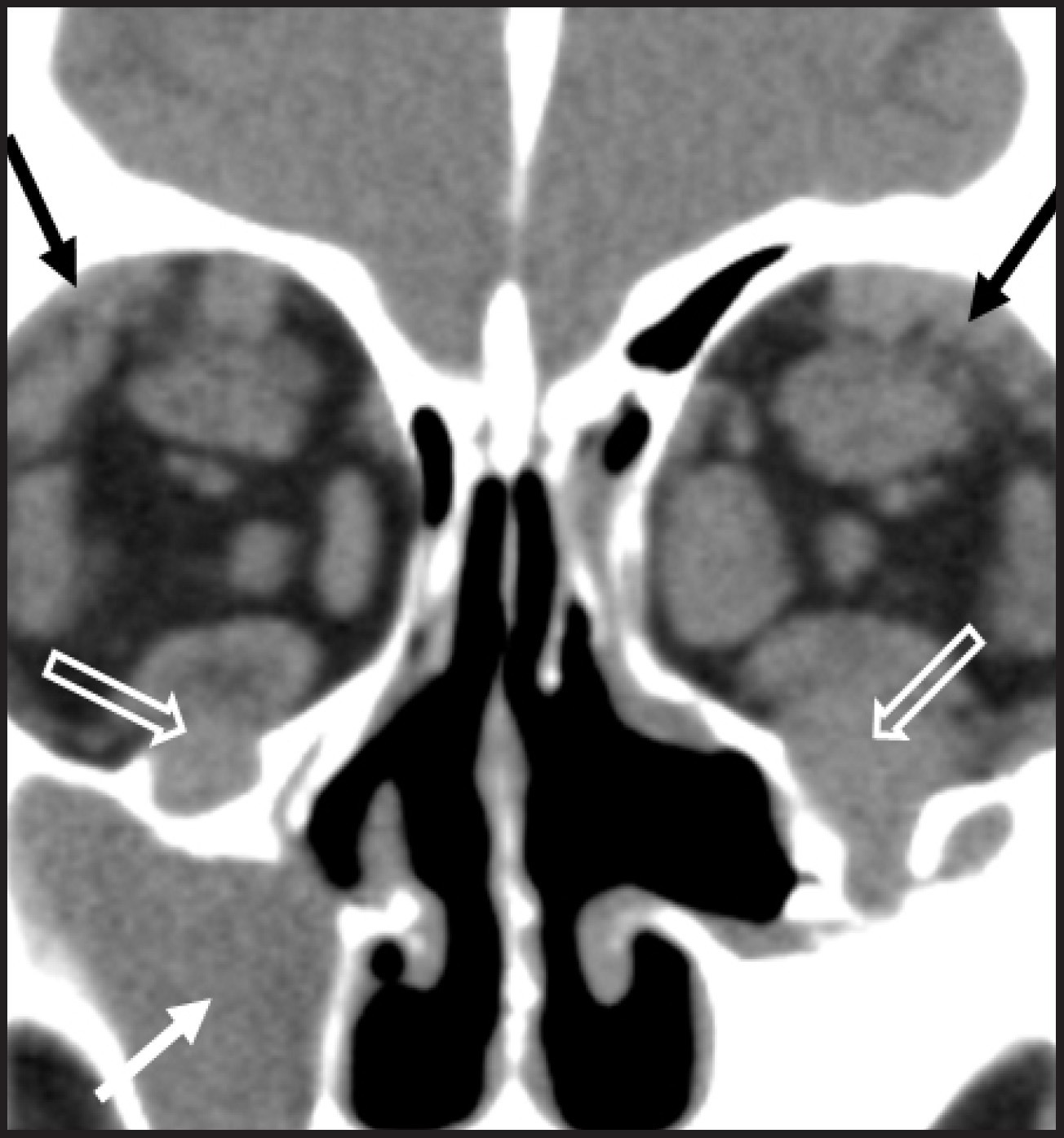 FIGURE 9.