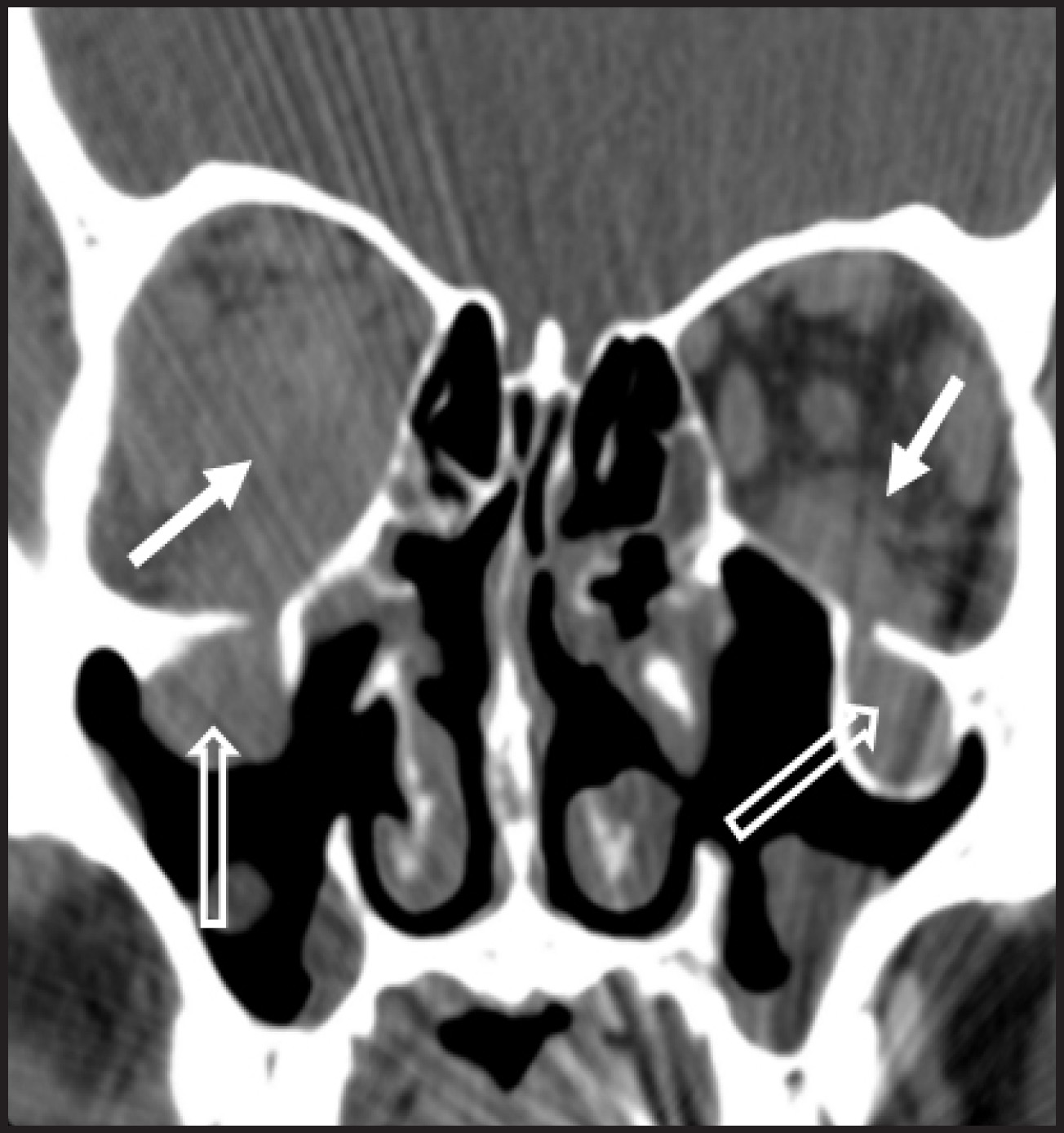 FIGURE 10.