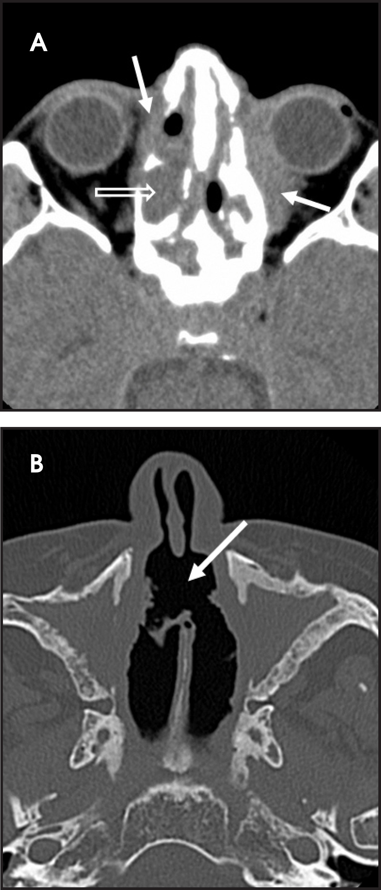 FIGURE 11.