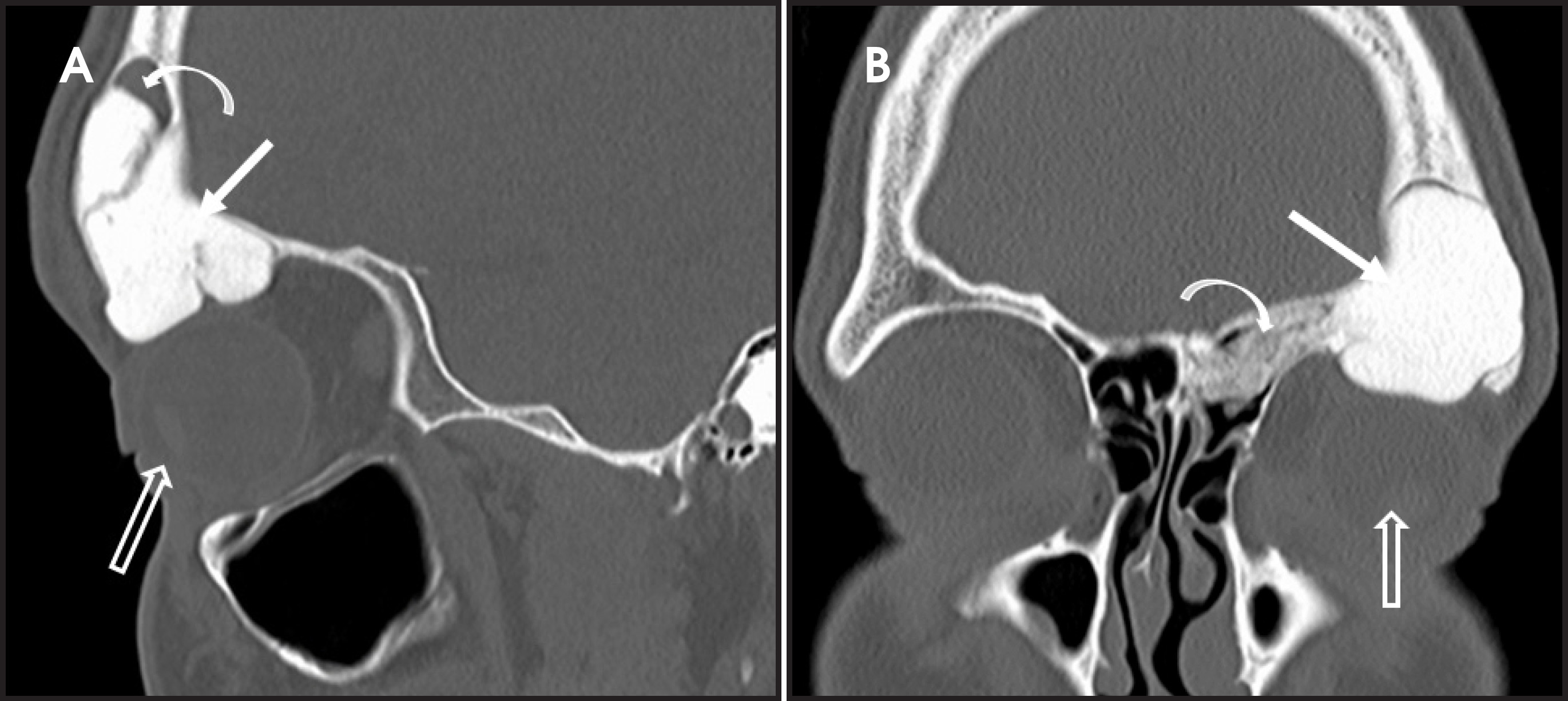 FIGURE 13.
