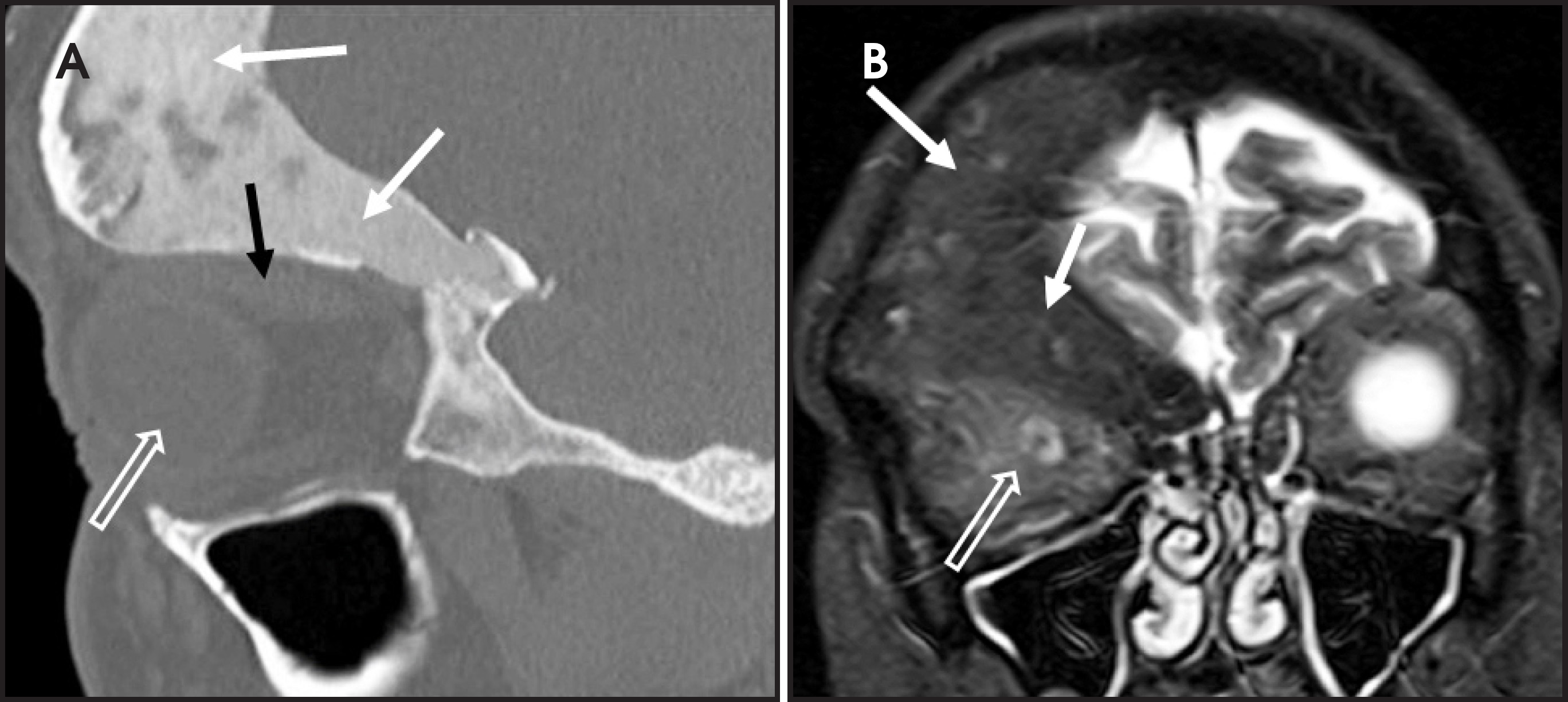 FIGURE 14.