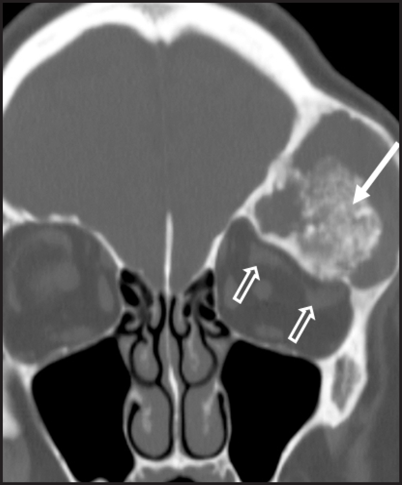 FIGURE 16.
