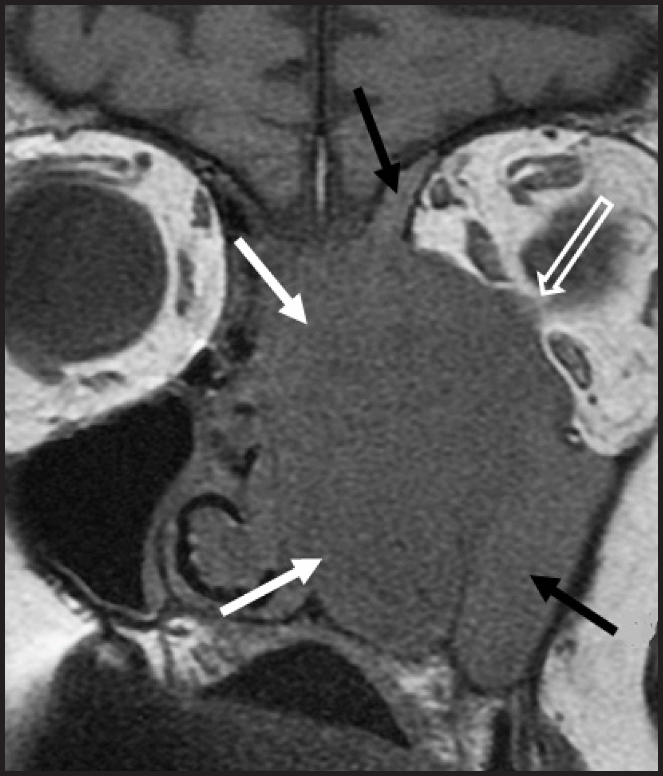 FIGURE 17.