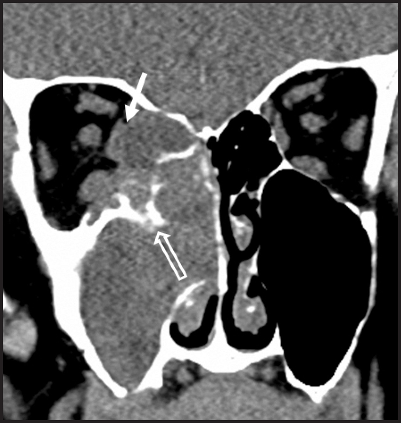 FIGURE 18.
