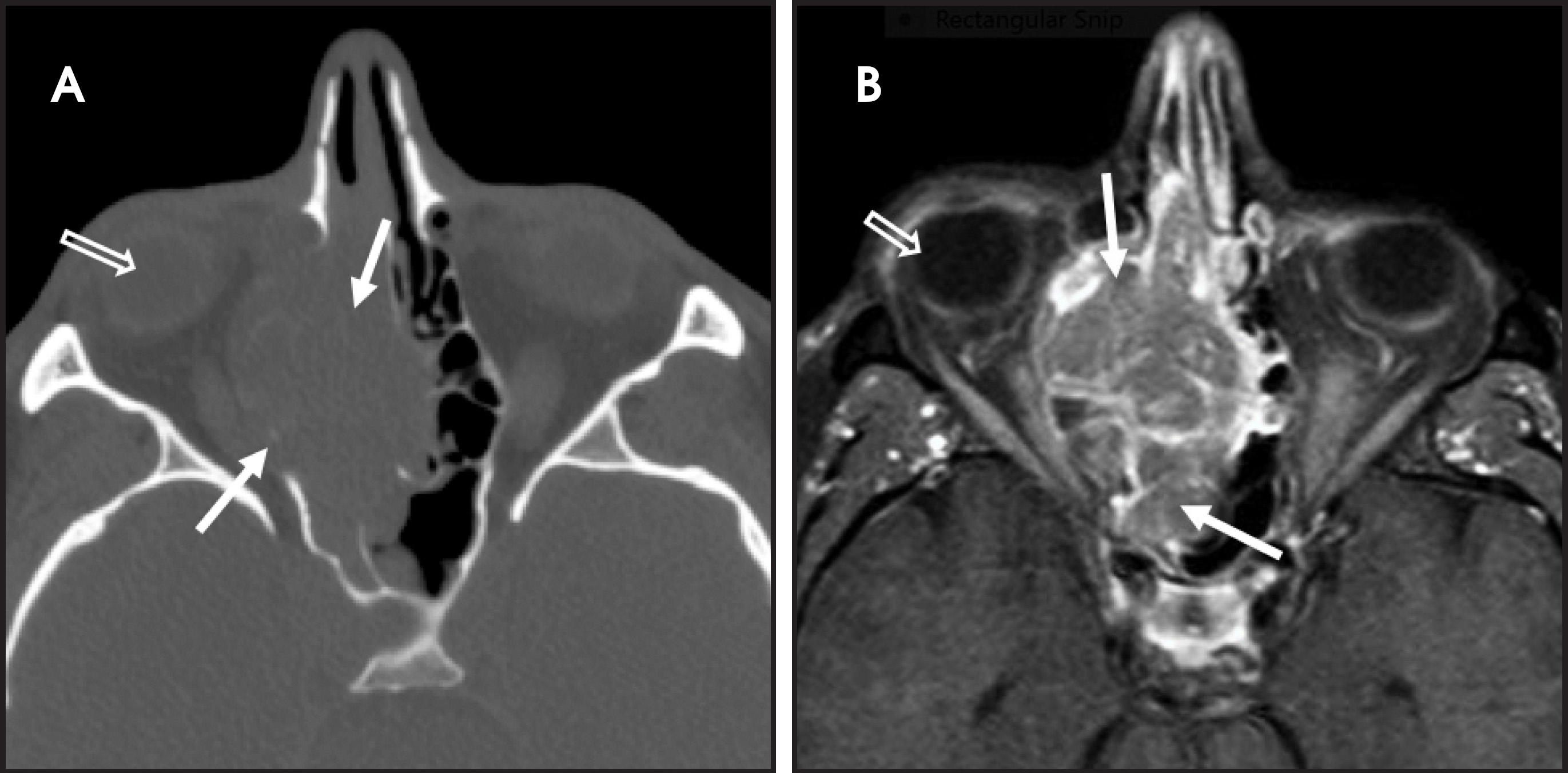 FIGURE 19.