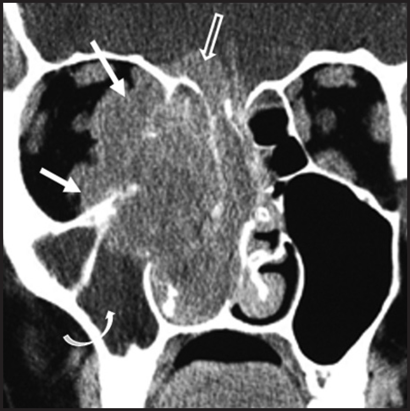 FIGURE 21.