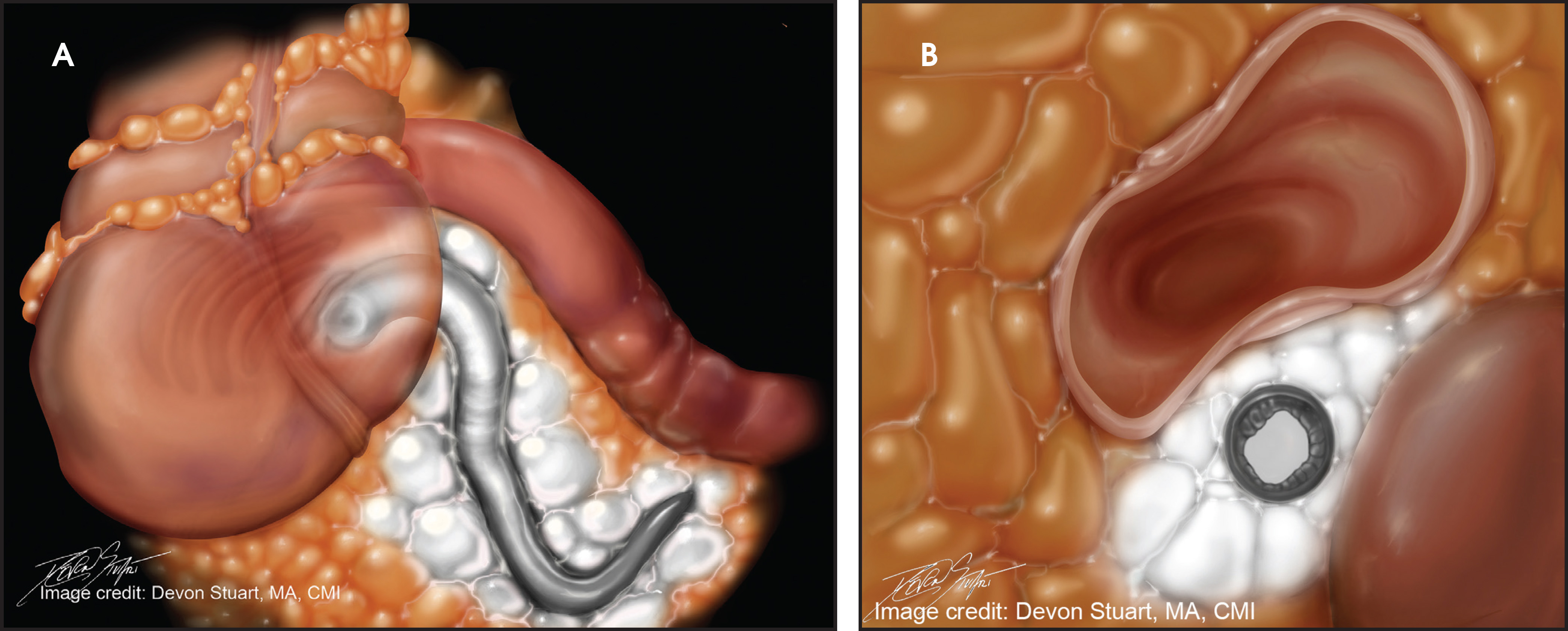 FIGURE 11.