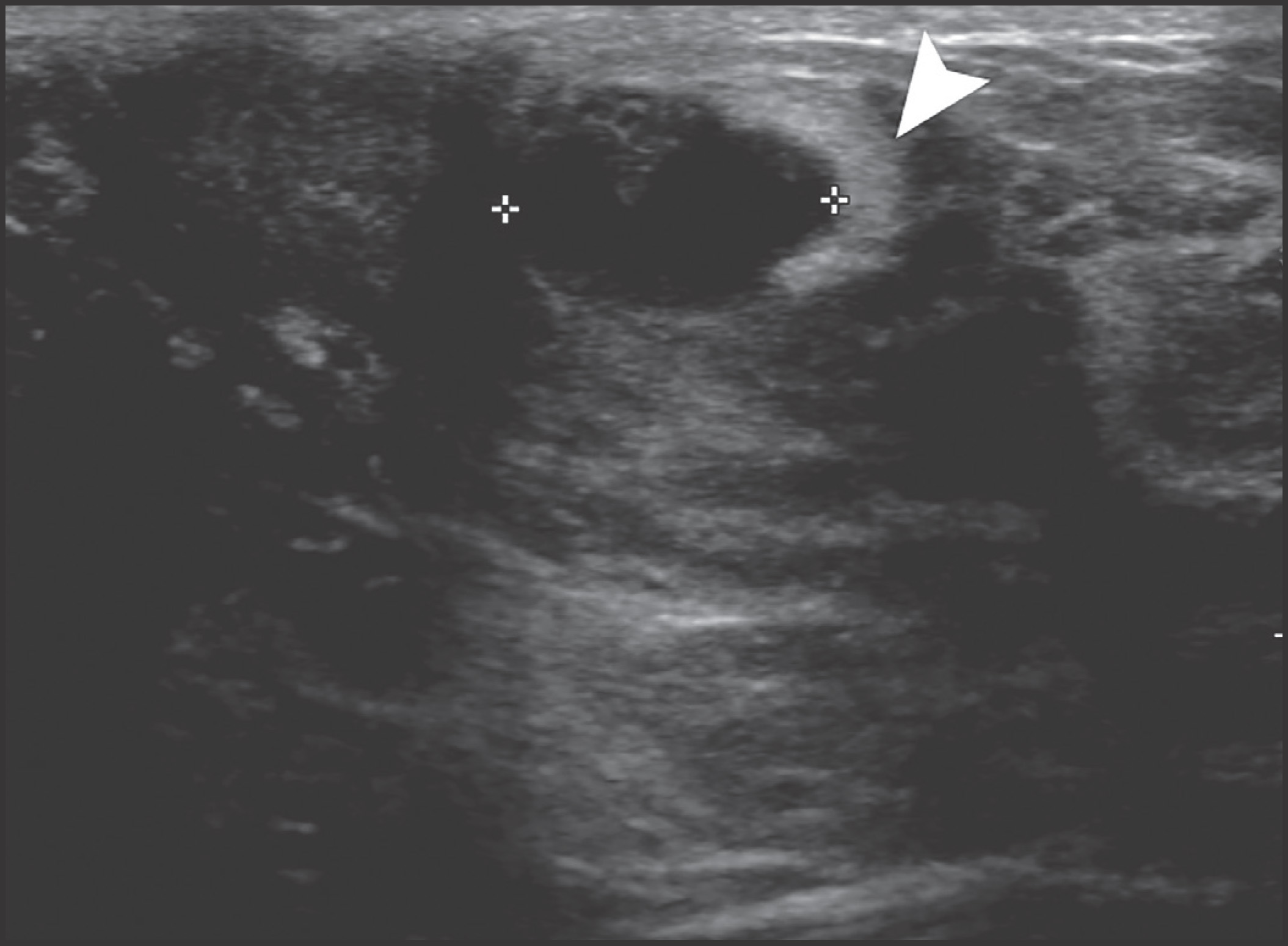FIGURE 4.
