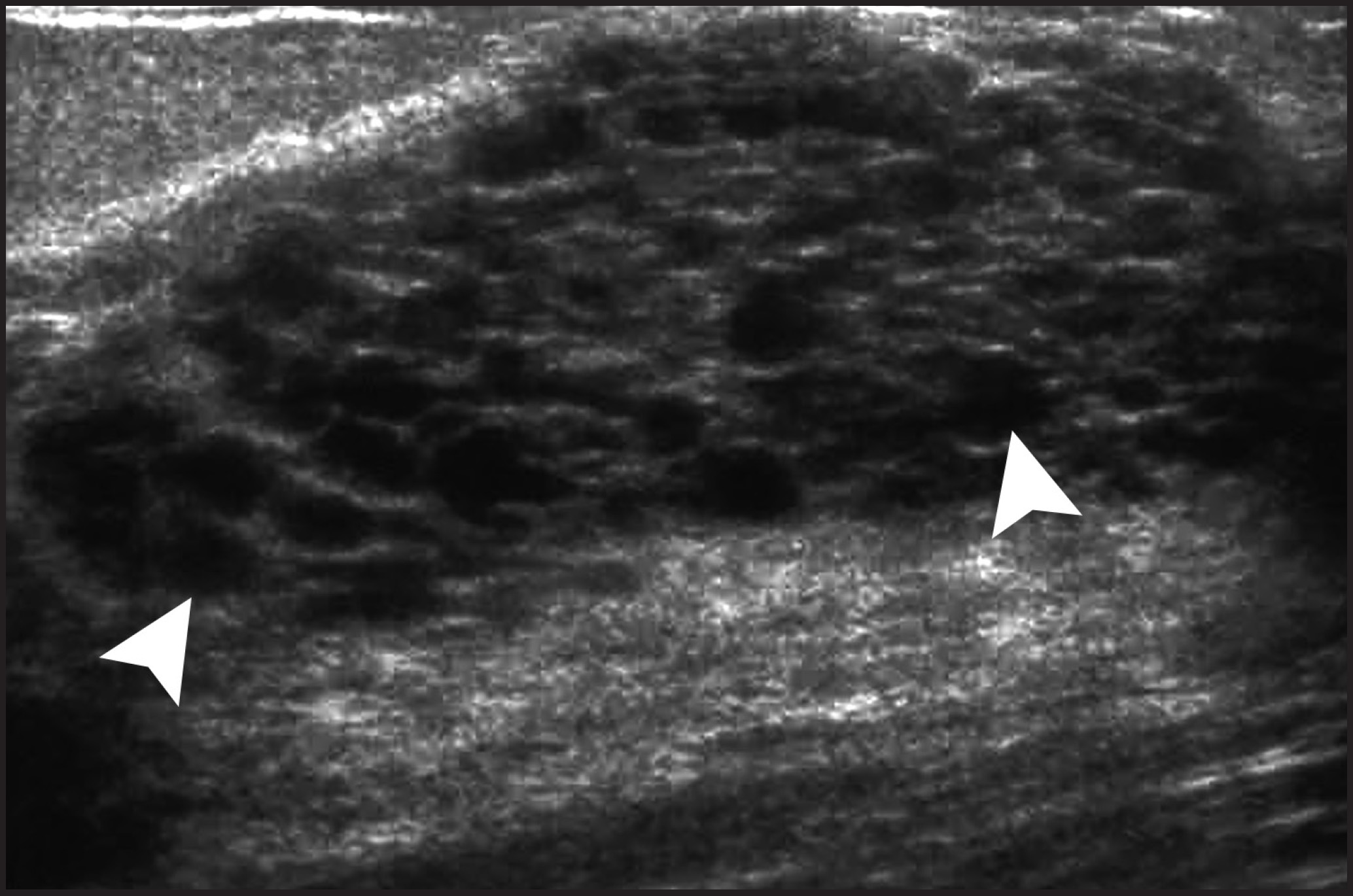 FIGURE 11.