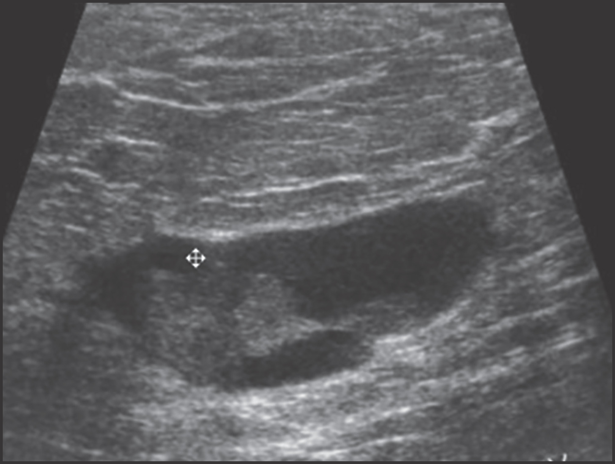 FIGURE 12.