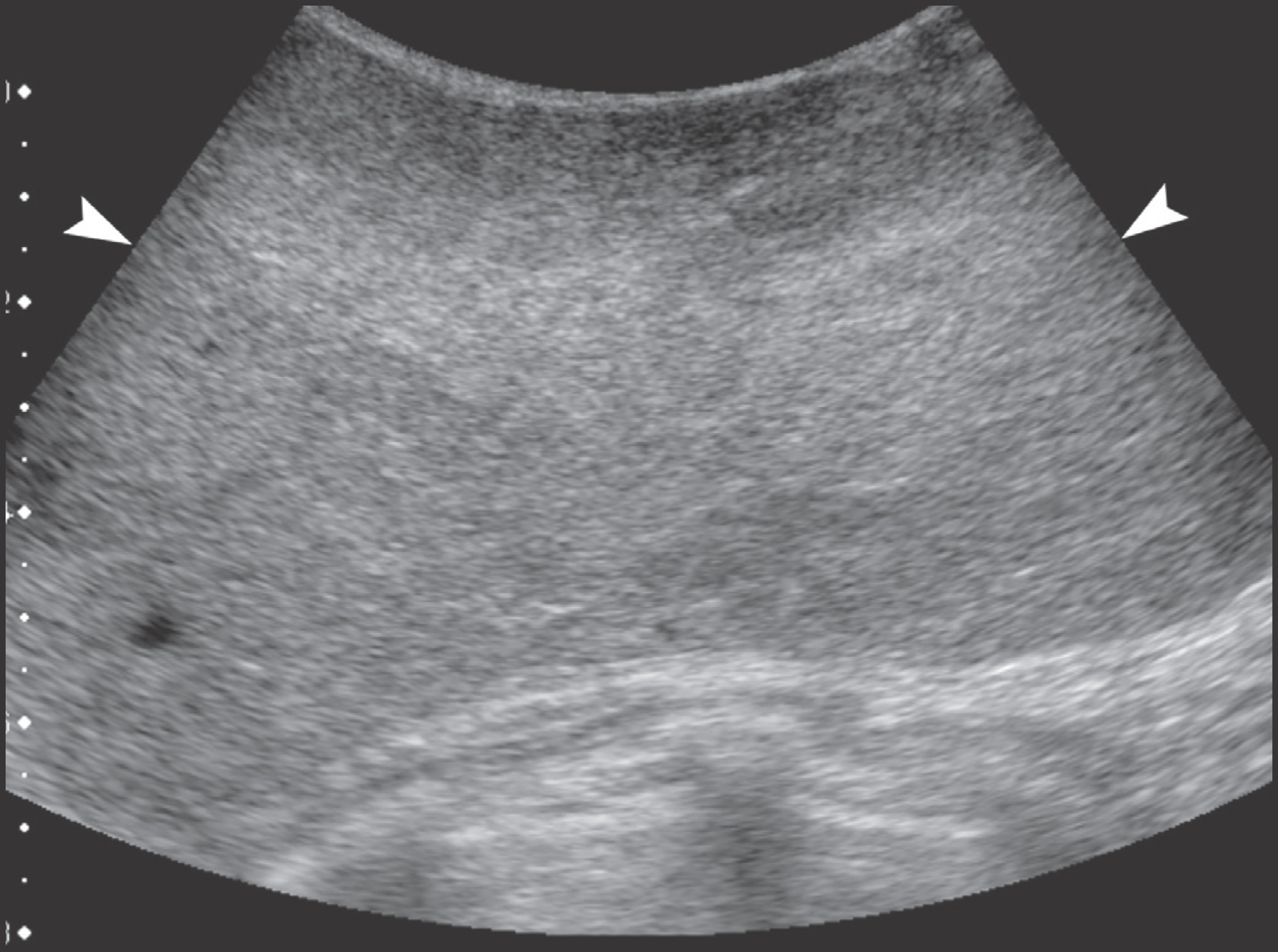 FIGURE 13.
