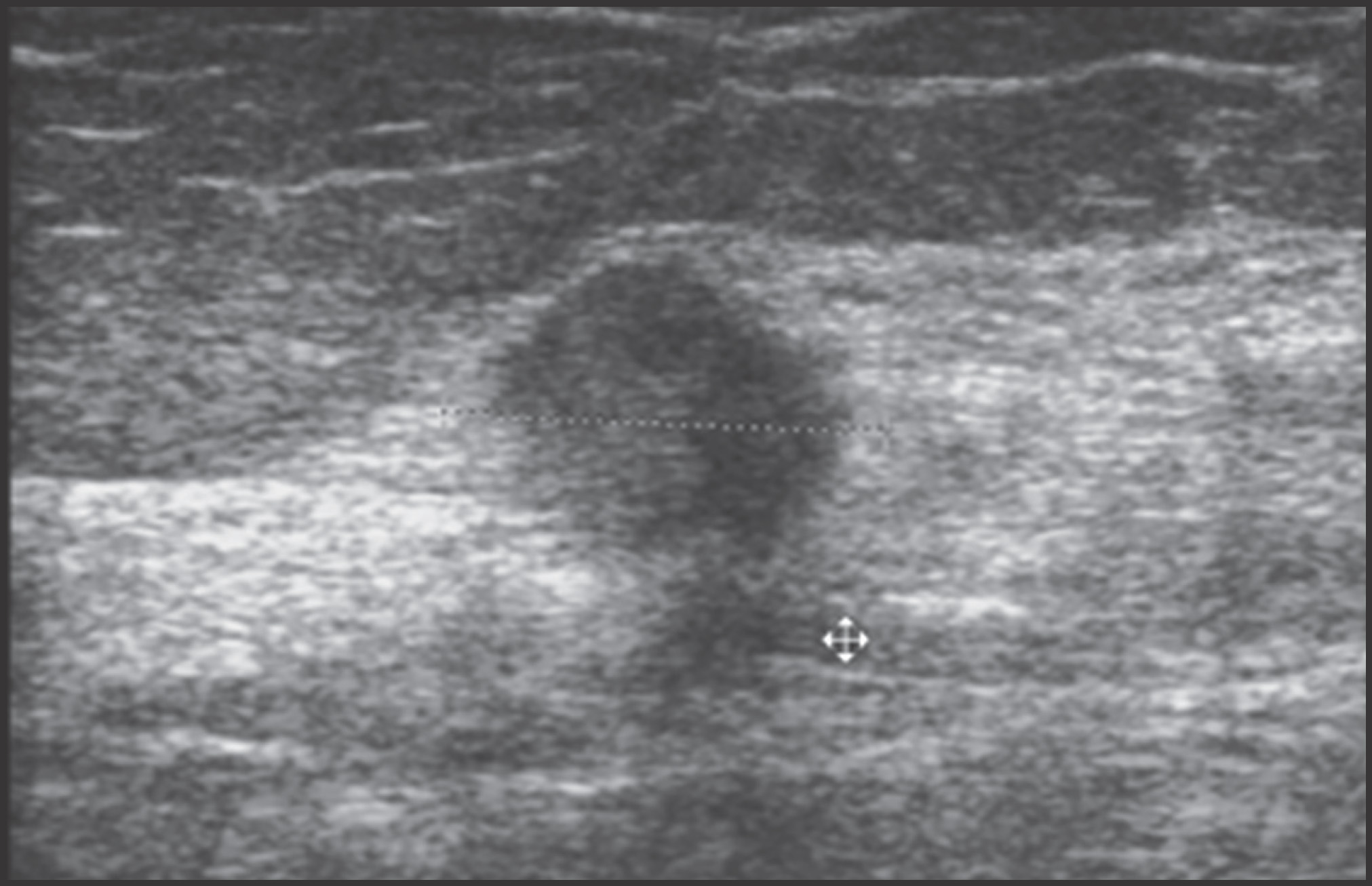 FIGURE 14.