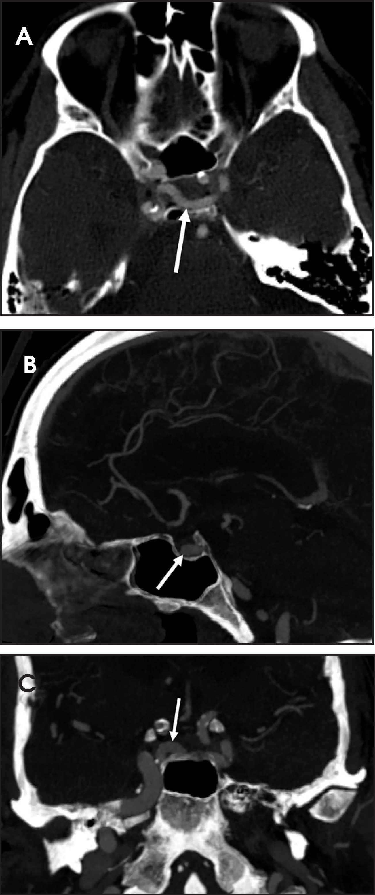 FIGURE 3.