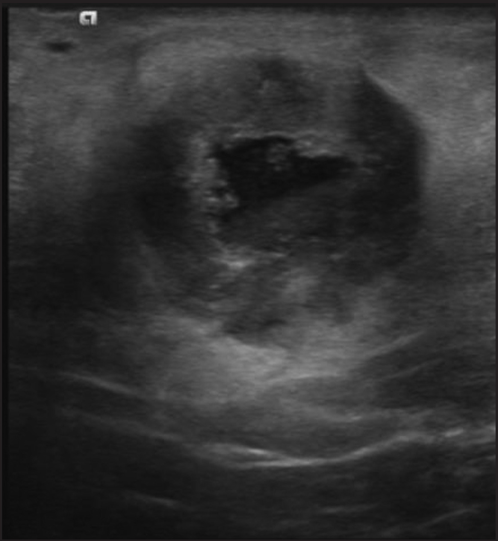 FIGURE 13.