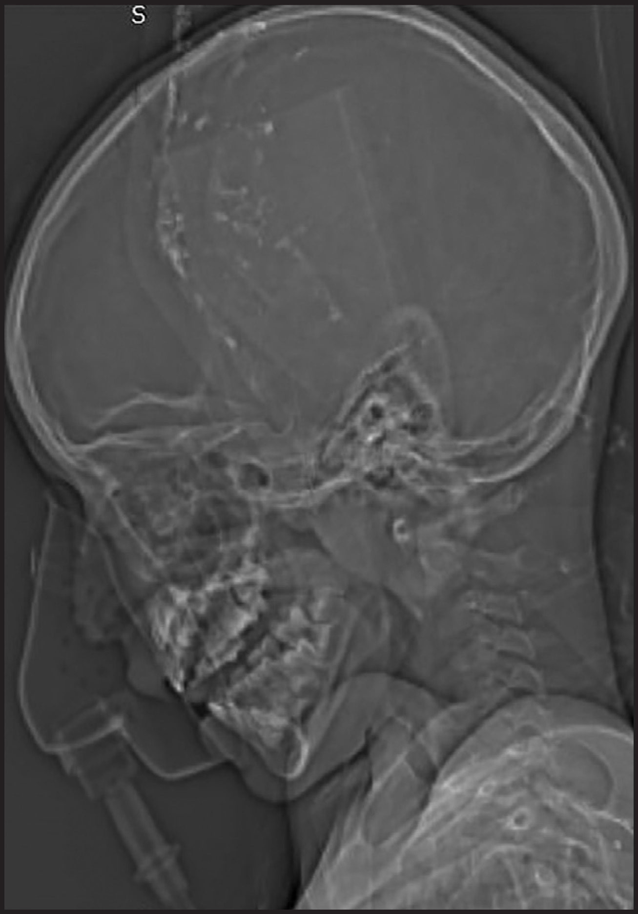 FIGURE 9.