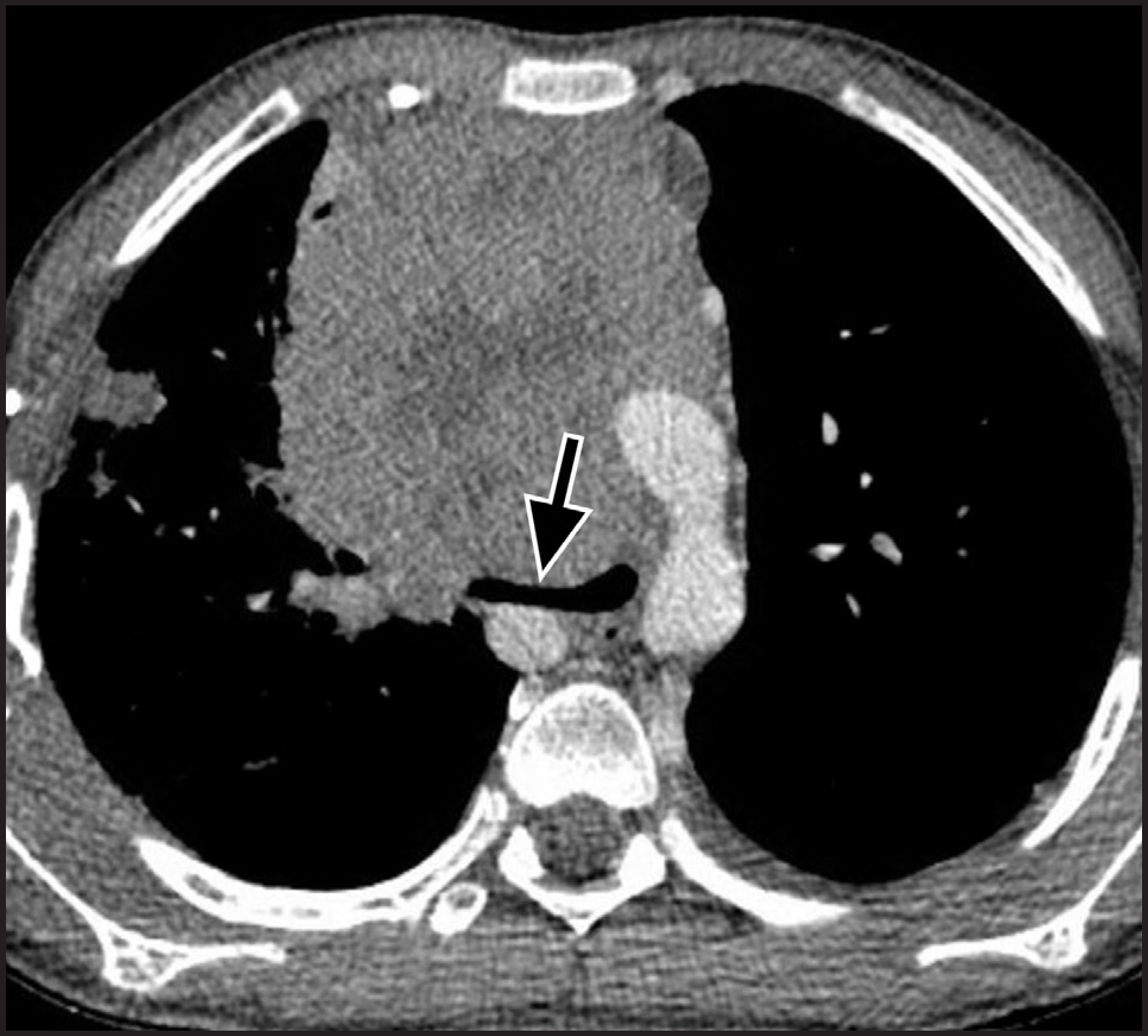 FIGURE 10.
