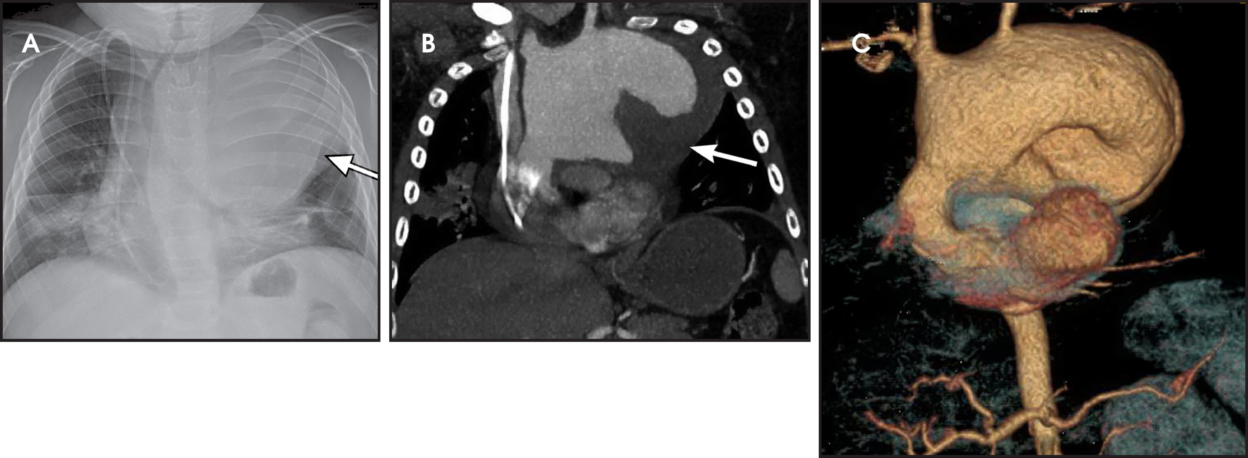 FIGURE 11.