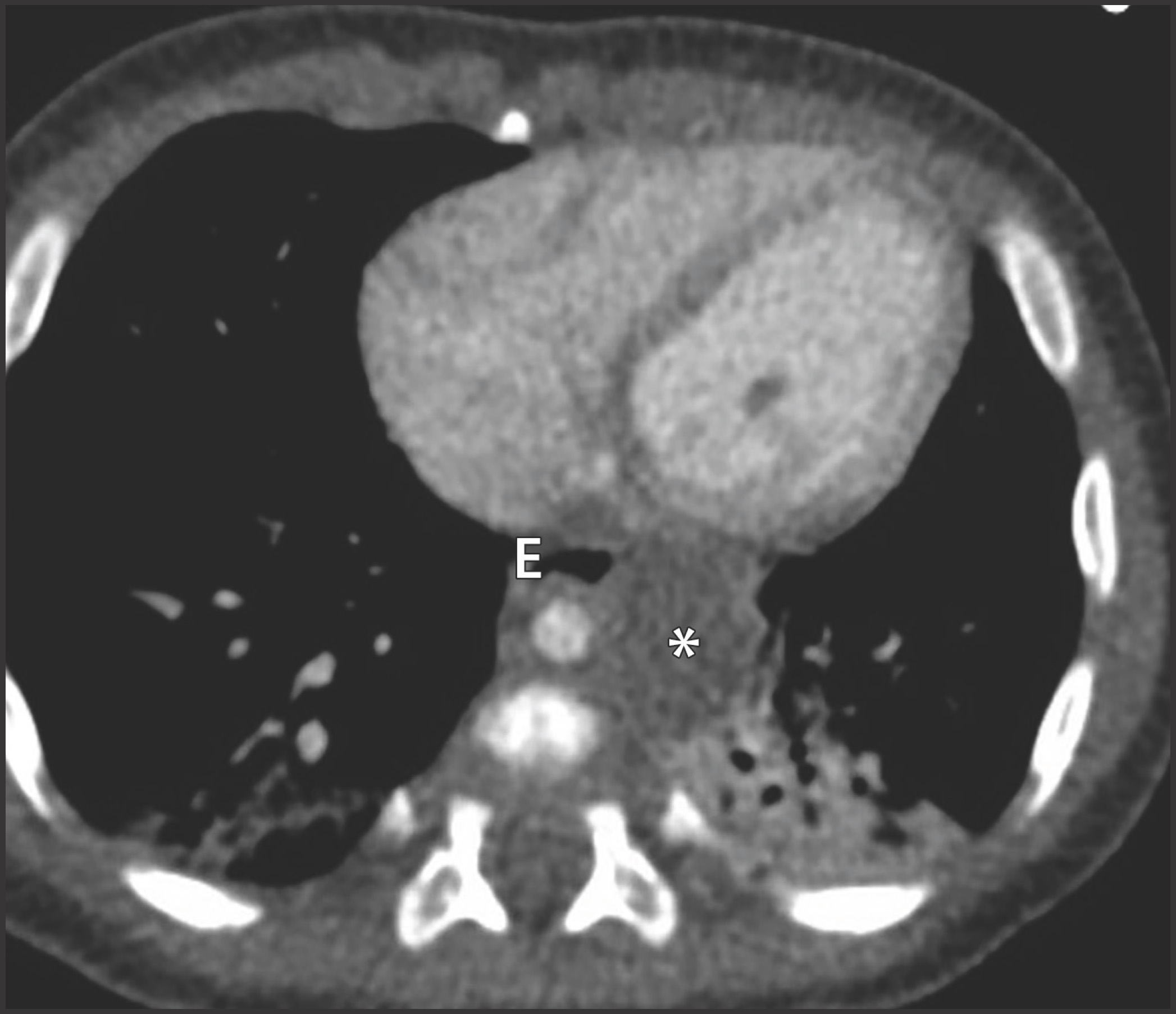 FIGURE 13.