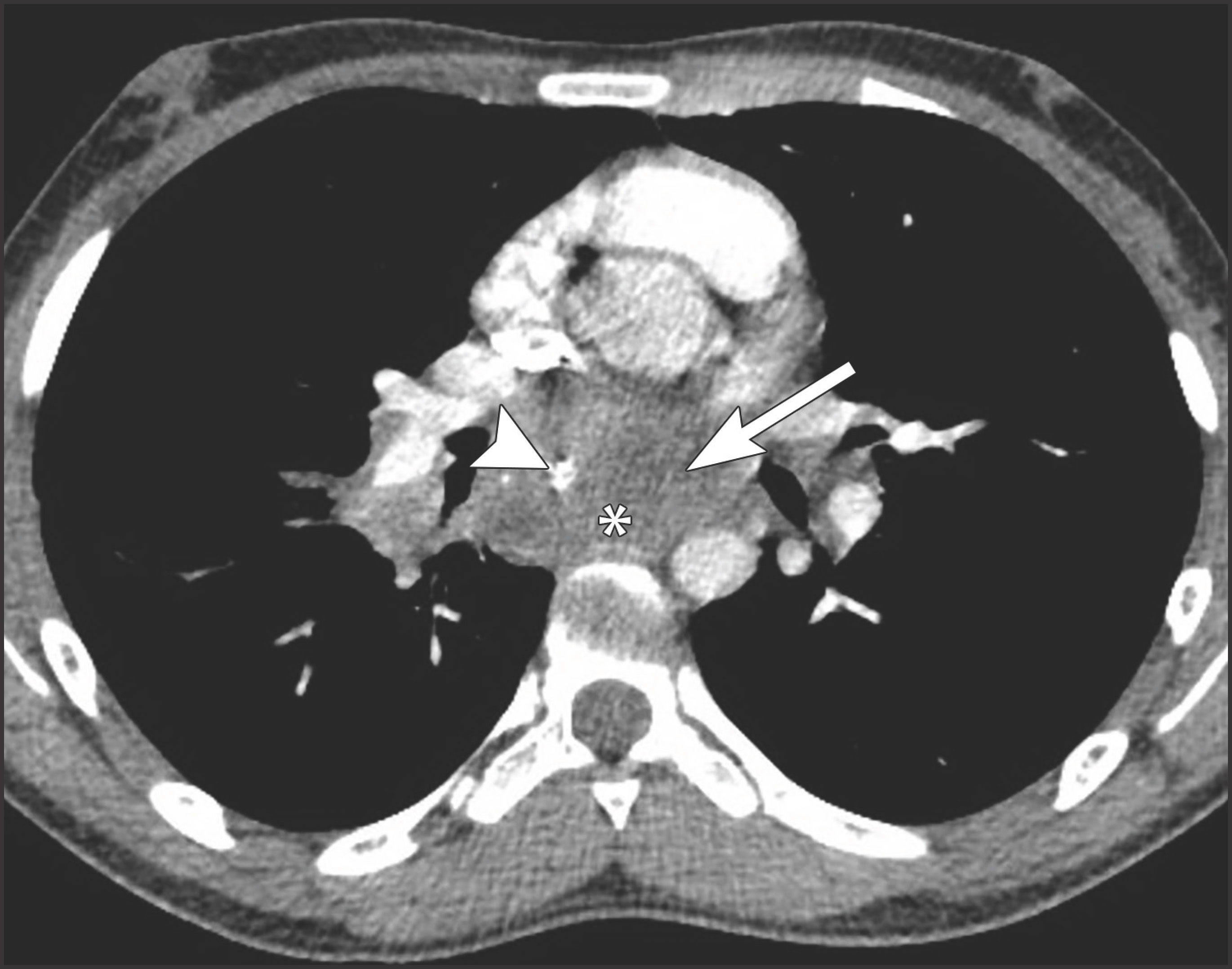 FIGURE 14.