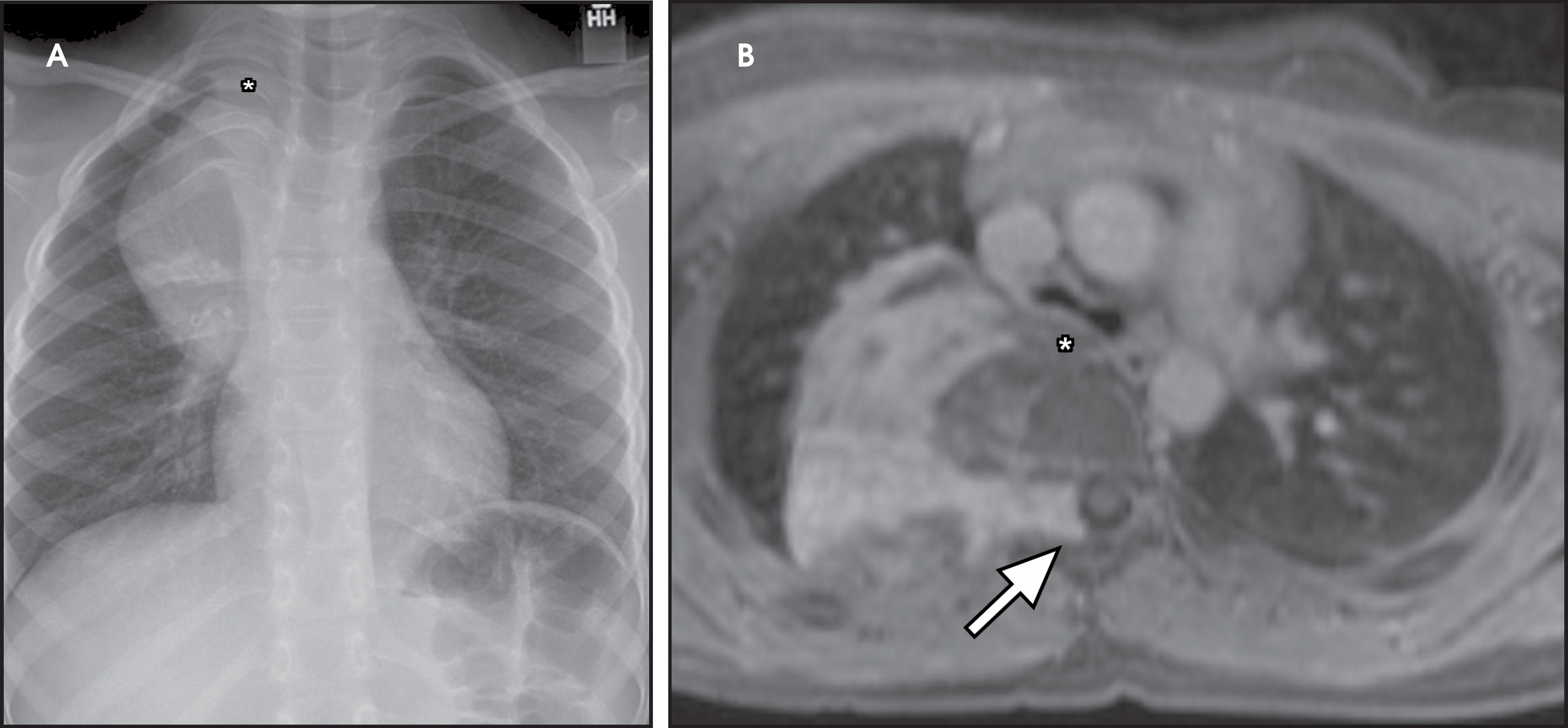 FIGURE 18.