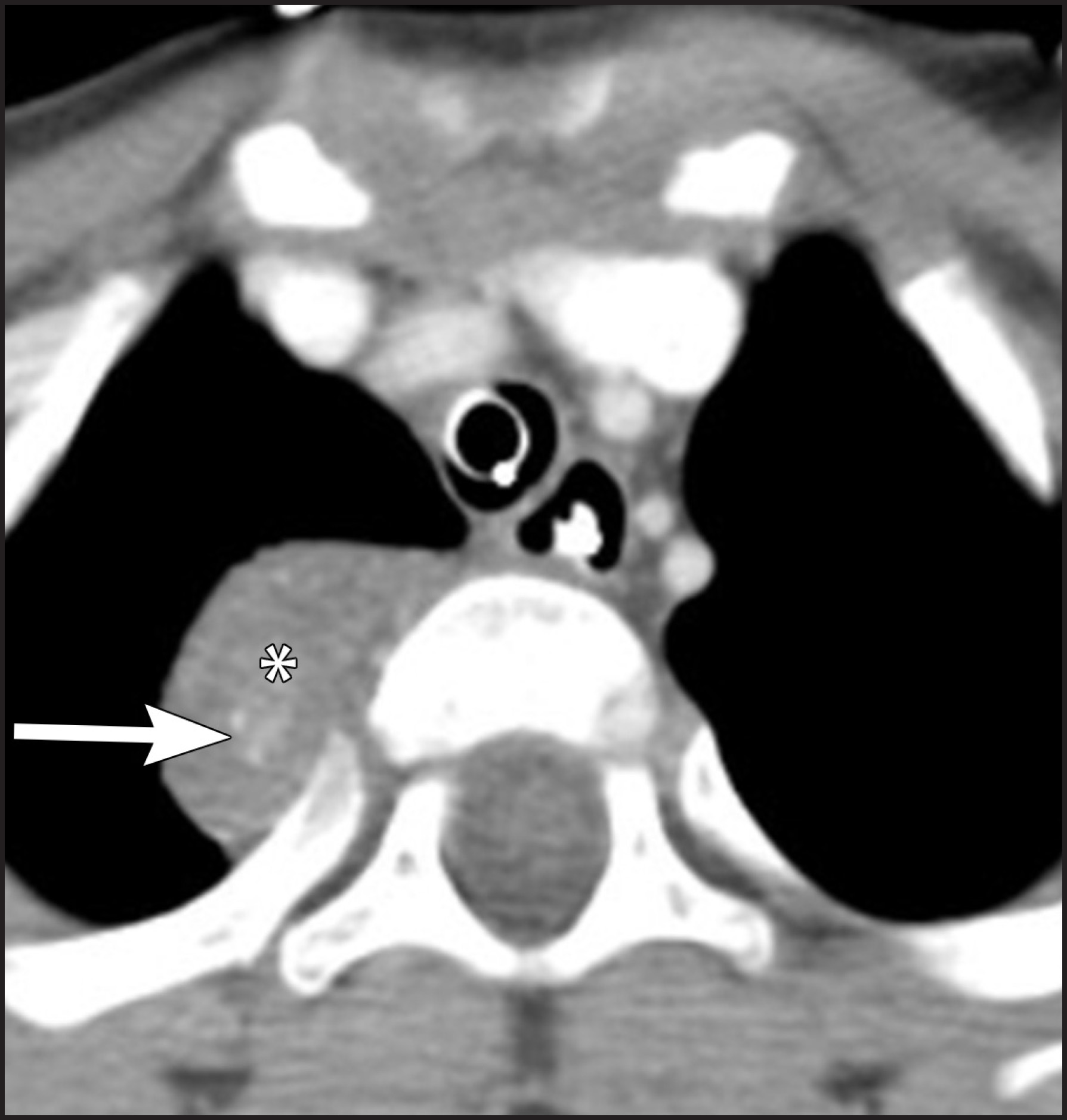 FIGURE 19.